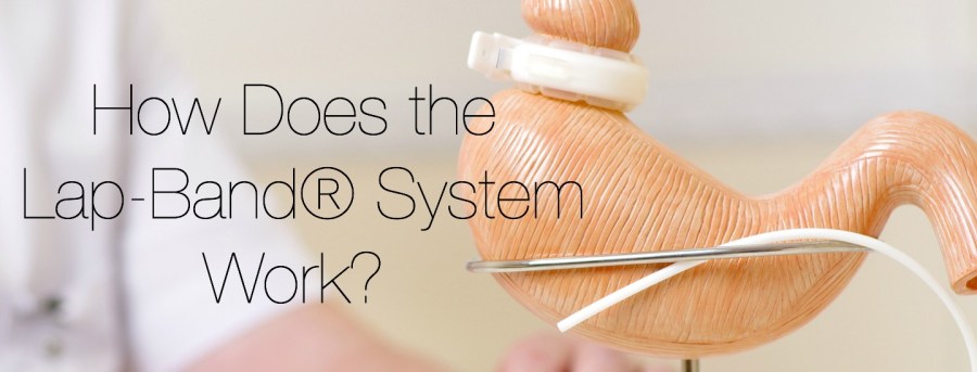 How Does Lap-Band® System&nbsp;Work?