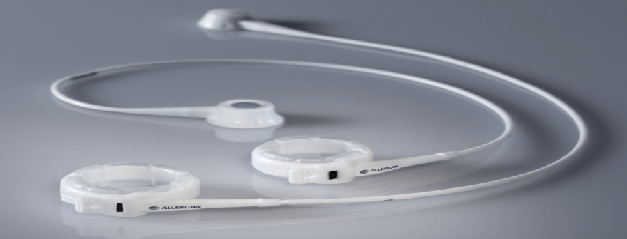 What is the LAP-BAND®&nbsp;System?