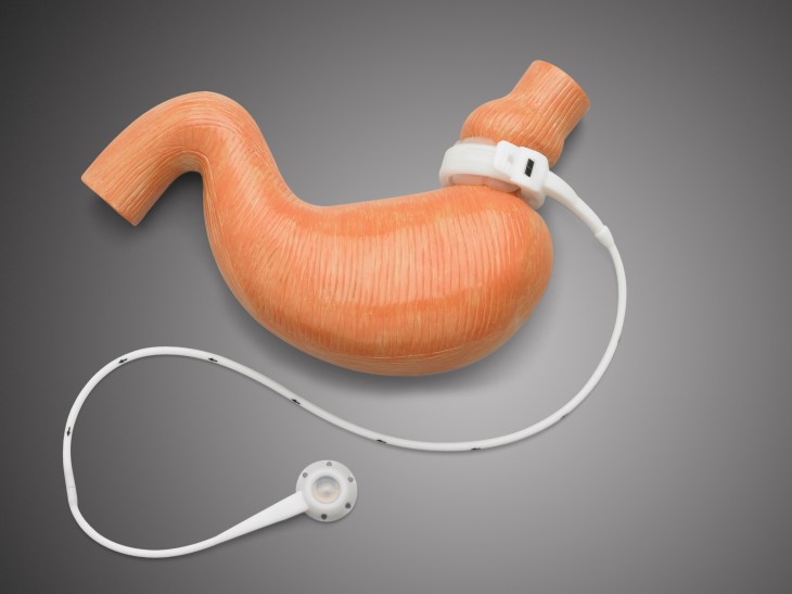 Dr. Keith McEwen MD Indianapolis Indiana Carmel Nobelsville Anderson Hamilton Community Surgery Center Hamilton Community Bariatrics Hamilton 46060 46011 46062 46033 46037 46074 46032 46220 46226 46055 46064 46030 46203 46239 46259 46163 46142 46143 lap-band system lap band system cost lap band system reviews lap band system patient education seminars lap band system access port lap band system pedometer lap band public system lap band ap system mri safety bioenterics lap band system lap-band ap system small lap band system lap-band system allergan lap band ap system large lap band gastric banding system franciscan health system lap band the new lap band system lap band through public system lap band surgery public system lap band system surgery the lap band system lap-band vg system what is lap band systemlap-band procedure lap-band removal lap-band system lap-band cost lap-band weight loss surgery lap-band complications lap-band diet lap-band® lap-band reviews lap-band alternative lap-band lap-band surgery lap-band adjustable gastric banding system lap band and pregnancy lap band australia lap band after gastric bypass lap band az lap band adjustment lap band and alcohol lap band and acid reflux lap band austin a lap band surgery a lap band removing a lap band can lapband be removed is a lap band permanent is a lap band safe is a lap band covered by insurance is a lap band reversible how a lap band works does a lap band work lap band before and after lap band before and after pictures lap band blog lap band before and after pics lap band brisbane lap band bmi lap band birmingham al lap band blockage lap band before and after stories lap band bariatric surgery b-2240 lap band lap band cost without insurance lap band covered by insurance lap band criteria lap band complications years later lap band canada lap band chicago lap band calgary lap band cons realize c lap band clap clap band clap clap bandcamp c section with lap band c-section and lap band surgery c section after lap band hepatitis c and lap band surgery lap band diet menu lap band diet plan lap band dallas lap band diet recipes lap band doctors lap band diet after surgery lap band dance lap band deaths lap band diet without surgery vitamin d deficiency lap band lap band erosion lap band edmonton lap band eligibility lap band erosion causes lap band eating plan lap band erosion lawsuit lap band experiences lap band eating rules lap band esophagus problems lap band erosion complications o que e lap band lap band forum lap band fill lap band failure lap band friendly recipes lap band forum australia lap band failure rate lap band food stuck lap band fill centers lap band failure stories lap band fort worth lap band gal lap band gone wrong lap band gas pain lap band gaining weight back lap band guidelines lap band gurgling noises lap band green zone lap band gallbladder issues lap band good or bad lap band gerd issues lap band houston lap band hypnosis lap band horror stories lap band heartburn and reflux lap band heartburn lap band hypnotherapy lap band houston cost lap band hobart lap band hair loss lap band hernia h pylori lap band lap band insurance lap band issues lap band in mexico lap band information lap band images lap band indiana lap band insurance requirements lap band infection lap band in houston lap band in mexico cost i lap band i want lap band surgery lap band jacksonville fl lap band journey lap band journey blog lap band jackson ms lap band joplin mo lap band joondalup lap band journal lap band jonesboro arkansas lap band jokes lap band juicing j&j lap band lap band kansas city lap band kaiser lap band knoxville tn lap band kelowna lap band killeen texas lap band katy tx lap band kidney stones lap band korea lap band kingsport tn lap band katy lap band lawsuit lap band las vegas lap band liquid diet lap band louisville ky lap band little rock ar lap band leak symptoms lap band lubbock lap band liquid diet recipes lap band long term complications lap band los angeles lap band mexico lap band meal plan lap band miami lap band mri safety lap band melbourne lap band meals lap band macon ga lap band medicare lap band memphis lap band mexico cost u of m lap band surgery lap band not working lap band not losing weight lap band night cough lap band nj lap band nz lap band nyc lap band no surgery lap band no weight loss lap band nausea lap band nutrition guidelines lite n easy lap band lap band or sleeve lap band okc lap band of louisville lap band ontario lap band orlando lap band operation lap band oklahoma lap band ontario cost lap band omaha lap band or sleeve which is better o sign lap band o'brien lap band placer cost of lap band surgery symptoms of lap band erosion removal of lap band dangers of lap band surgery symptoms of lap band slippage complications of lap band surgery complications of lap band cost of lap band removal lap band problems lap band pictures lap band pros and cons lap band pre op diet lap band port lap band price lap band port pain lap band post op diet lap band pregnancy s p lap band lap band qualifications lap band qualifications 2014 lap band qualifications 2015 lap band qualifications 2013 lap band questions lap band questions and answers lap band quiz lap band queensland lap band quick weight loss lap band qld q&a lap band lap band requirements lap band recipes lap band recovery lap band risks lap band results lap band removal recovery lap band removal surgery lap band removal complications lap-band surgery pros and cons lap band surgery cost lap band side effects lap band slippage lap band surgery reviews lap band surgery requirements lap band success stories lap band surgery risks s code for lap band adjustment what is lap band lap band talk lap band toronto lap band to sleeve revision lap band to gastric sleeve lap band testimonials lap band to gastric sleeve revision lap band tulsa lap band tucson lap band to gastric sleeve conversion lap band to sleeve conversion lap band t shirt lap band utah lap band uk lap band utah cost lap band unfill lap band united healthcare lap band ulcer lap band unfilled problems lap band ulcer issues lap band unsuccessful stories lap band upper gi youtube lap band youtube lap band surgery lap band u of m lap band vs sleeve lap band vomiting lap band video lap band vs bypass lap band vomiting after eating lap band vs sleeve 2013 lap band vomiting slime lap band vancouver lap band vs slimband lap band vomiting in sleep gastric bypass v lap band lap band v sleeve lap band weight loss lap band with plication lap band wiki lap band weight loss expectations lap band without surgery lap band weight loss results lap band weight requirements lap band weight loss first month lap band weight loss rate lap band w/plication lap band x ray gastric band x ray lap band slippage x ray slipped lap band x ray lap band position x ray gastric lap band x ray lap band angle x ray lap band surgery x ray x ray of lap band x ray of slipped lap band gas x after lap band lap band youtube lap band youtube video lap band youtube before and after lap band yahoo answers lap band yes or no lap band young adults lap band yuma az lap band years later lap band york pa lap band youtube 2012 lap band zones lap band zephyrhills florida gastric band zones lap band red zone lap band surgery zanesville ohio lap band new zealand lap band cost new zealand zoloft lap band lap band surgery christchurch new zealand gastric band zürich lap band 10 years later lap band 1st fill lap band 1 year later lap band 1 week post op lap band 101 lap band 1 month post-op lap band 18 years old lap band 16 year old lap band 14cc lap band 15 year old 1 800 lap band week 1 lap band diet lap band 2014 lap band 2013 lap band 2 week liquid diet lap band 2015 lap band 20 years old lap band 2 years post-op lap band 2 weeks post op lap band 2 months post op lap band 22 years old lap band 200 lbs week 2 lap band diet 2 year old lap band 2 dangers of lap band surgery 2 years after lap band 2 months after lap band 2 weeks after lap band lap band 2 years later day 2 after lap band lap band 30 pounds overweight lap band 3 weeks post op lap band 3 months post op lap band 3 years post op lap band 3 days post op lap band 35 bmi lap band 3 months later lap band 3 years later lap band 33 bmi lap band 31 bmi stage 3 lap band diet 3 lap joint band clamp week 3 lap band diet phase 3 lap band diet 3 months after lap band 3 days post lap band week 3 post lap band lap band 4 years later lap band 40 pounds overweight lap band 400 lbs lap band 4cc lap band after 4 years lap band for 40 lbs. overweight lap band week 4 allergan lap band 4cc lap band stage 4 diet lap band to lose 40 pounds stage 4 lap band diet 4 years after lap band 4 weeks after lap band lap band 5 years later lap band 5 day pouch test lap band 5 years post op lap band 50 lbs overweight lap band 5 cc fill lap band 5 months post op lap band 5 weeks post-op lap band $5000 lap band 50 pounds overweight lap band 5 day diet stage 5 lap band diet 5 years after lap band 5 days post op lap-band lap band 6 months post op lap band 60 pounds overweight lap band 6 years later lap band 6 cc fill lap band 6 weeks post op lap band 6 month diet lap band after 6 years lap band after 6 months lap band surgery over 60 lap band surgery over 65 6 months after lap band lap band 70 pounds overweight lap band after 7 years lap band surgery 77062 lap band 8 golden rules lap band after 8 years 800 lap band 8 golden rules lap band 8 rules of lap band lap band icd 9 lap band icd-9 code lap band erosion icd 9 lap band removal icd 9 lap band complication icd 9 lap band failure icd 9 slipped lap band icd-9 code 9.75 lap band infected lap band icd 9 icd 9 lap band complications icd 9 lap band icd 9 lap band surgery icd 9 lap band adjustment icd 9 gastric lap band icd 9 failed lap band icd 9 for lap band erosion bariatric banding surgery bariatric band surgery cost bariatric band diet bariatric band slippage bariatric band fills bariatric band complications bariatric band adjustment bariatric band manufacturers bariatric lap band bariatric lap band surgery problems bariatric band bariatric band surgery lap band bariatric surgery stomach band after pregnancy stomach band after c section stomach band as seen on tv stomach band after hysterectomy stomach band and cream to lose weight stomach band alternative stomach band at walmart stomach band and pregnancy stomach band after cesarean bariatric belly band stomach burner band stomach band before and after stomach band belt baby stomach band best stomach band after pregnancy best stomach band ballet stomach band lap band bariatric surgery before after bariatric surgery bypass vs band stomach band cost laparoscopic band complications stomach band covered by insurance stomach band cost canada stomach band canada stomach band cost sydney stomach band cost uk laparoscopic band cost stomach band candidate stomach band during pregnancy stomach band diabetes bariatric lap band diet bariatric surgery lap band diet stomach band exercise stomach band erosion stomach elastic band stomach earth band stomach elastic band surgery' stomach band to lose weight stomach band for working out stomach band for after pregnancy stomach band for pregnancy stomach band for exercise stomach band for acid reflux stomach band for running stomach band for abs stomach band for working out walmart stomach band hypnosis stomach band holster stomach band hypnotherapy stomach heat band stomach band infomercial stomach band in pakistan i-band bariatric surgery stomach band japanese stomach band japan stomach band lose weight stomach lift band lap band bariatric surgery cost lap band bariatric surgery forums lap band vs bariatric surgery bariatric lap band surgery diet bariatric lap band recipes stomach band mexico stomach band modells stomach muscle band stomach monkeys band stomach mouth band stomach band nz stomach band operation stomach band on nhs lap band or bariatric surgery stomach omaha band stomach band procedure stomach band post pregnancy stomach band pregnancy stomach band price stomach band problems laparoscopic band phi angle laparoscopic band placement laparoscopic band port stomach band perth laparoscopic band passer laparoscopic band removal stomach band reviews laparoscopic band radiographics stomach band removal laparoscopic band removal cpt code stomach band requirements stomach band risks stomach band recovery time laparoscopic band radiology laparoscopic band removal cpt bariatric surgery band slip stomach band surgery cost laparoscopic band surgery stomach band surgery risks stomach band surgery cost canada stomach band side effects laparoscopic band surgery cost stomach band to lose belly fat stomach band to lose weight cost stomach band that burns fat stomach band that makes you sweat stomach band to sweat stomach band to lose weight as seen on tv stomach band to workout stomach band toronto stomach band target stomach band uk stomach vibrating band lap band vs sleeve bariatric surgery bariatric sleeve vs band bariatric advantage vitaband stomach band walmart stomach band workout stomach band while working out stomach band wrap stomach band with gel stomach band while exercising stomach band wiki stomach band working out stomach band with lotion stomach band youtube