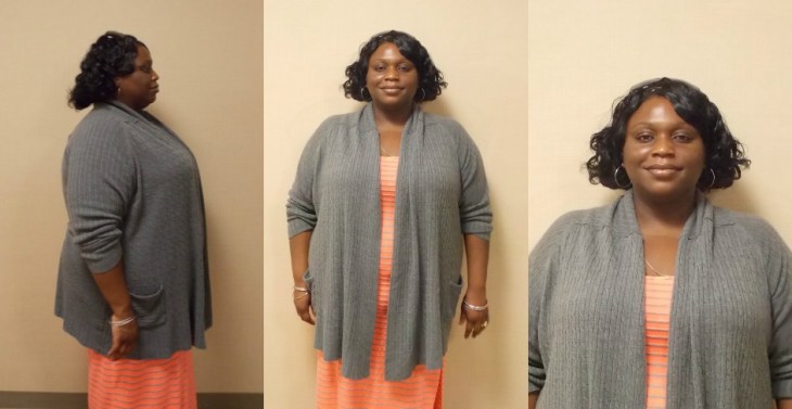 tt1-amber-2-dr-keith-mcewen-lab-band-hamilton-indianapolis-indiana-obesity-center-317-621-2500