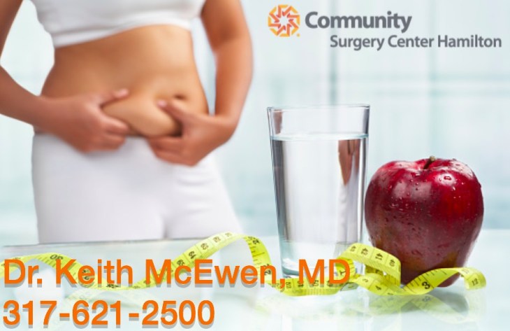 Dr. Keith McEwen MD Indianapolis Indiana Carmel Nobelsville Anderson Hamilton Community Surgery Center Hamilton Community Bariatrics Hamilton 46060 46011 46062 46033 46037 46074 46032 46220 46226 46055 46064 46030 46203 46239 46259 46163 46142 46143 lap-band system lap band system cost lap band system reviews lap band system patient education seminars lap band system access port lap band system pedometer lap band public system lap band ap system mri safety bioenterics lap band system lap-band ap system small lap band system lap-band system allergan lap band ap system large lap band gastric banding system franciscan health system lap band the new lap band system lap band through public system lap band surgery public system lap band system surgery the lap band system lap-band vg system what is lap band systemlap-band procedure lap-band removal lap-band system lap-band cost lap-band weight loss surgery lap-band complications lap-band diet lap-band® lap-band reviews lap-band alternative lap-band lap-band surgery lap-band adjustable gastric banding system lap band and pregnancy lap band australia lap band after gastric bypass lap band az lap band adjustment lap band and alcohol lap band and acid reflux lap band austin a lap band surgery a lap band removing a lap band can lapband be removed is a lap band permanent is a lap band safe is a lap band covered by insurance is a lap band reversible how a lap band works does a lap band work lap band before and after lap band before and after pictures lap band blog lap band before and after pics lap band brisbane lap band bmi lap band birmingham al lap band blockage lap band before and after stories lap band bariatric surgery b-2240 lap band lap band cost without insurance lap band covered by insurance lap band criteria lap band complications years later lap band canada lap band chicago lap band calgary lap band cons realize c lap band clap clap band clap clap bandcamp c section with lap band c-section and lap band surgery c section after lap band hepatitis c and lap band surgery lap band diet menu lap band diet plan lap band dallas lap band diet recipes lap band doctors lap band diet after surgery lap band dance lap band deaths lap band diet without surgery vitamin d deficiency lap band lap band erosion lap band edmonton lap band eligibility lap band erosion causes lap band eating plan lap band erosion lawsuit lap band experiences lap band eating rules lap band esophagus problems lap band erosion complications o que e lap band lap band forum lap band fill lap band failure lap band friendly recipes lap band forum australia lap band failure rate lap band food stuck lap band fill centers lap band failure stories lap band fort worth lap band gal lap band gone wrong lap band gas pain lap band gaining weight back lap band guidelines lap band gurgling noises lap band green zone lap band gallbladder issues lap band good or bad lap band gerd issues lap band houston lap band hypnosis lap band horror stories lap band heartburn and reflux lap band heartburn lap band hypnotherapy lap band houston cost lap band hobart lap band hair loss lap band hernia h pylori lap band lap band insurance lap band issues lap band in mexico lap band information lap band images lap band indiana lap band insurance requirements lap band infection lap band in houston lap band in mexico cost i lap band i want lap band surgery lap band jacksonville fl lap band journey lap band journey blog lap band jackson ms lap band joplin mo lap band joondalup lap band journal lap band jonesboro arkansas lap band jokes lap band juicing j&j lap band lap band kansas city lap band kaiser lap band knoxville tn lap band kelowna lap band killeen texas lap band katy tx lap band kidney stones lap band korea lap band kingsport tn lap band katy lap band lawsuit lap band las vegas lap band liquid diet lap band louisville ky lap band little rock ar lap band leak symptoms lap band lubbock lap band liquid diet recipes lap band long term complications lap band los angeles lap band mexico lap band meal plan lap band miami lap band mri safety lap band melbourne lap band meals lap band macon ga lap band medicare lap band memphis lap band mexico cost u of m lap band surgery lap band not working lap band not losing weight lap band night cough lap band nj lap band nz lap band nyc lap band no surgery lap band no weight loss lap band nausea lap band nutrition guidelines lite n easy lap band lap band or sleeve lap band okc lap band of louisville lap band ontario lap band orlando lap band operation lap band oklahoma lap band ontario cost lap band omaha lap band or sleeve which is better o sign lap band o'brien lap band placer cost of lap band surgery symptoms of lap band erosion removal of lap band dangers of lap band surgery symptoms of lap band slippage complications of lap band surgery complications of lap band cost of lap band removal lap band problems lap band pictures lap band pros and cons lap band pre op diet lap band port lap band price lap band port pain lap band post op diet lap band pregnancy s p lap band lap band qualifications lap band qualifications 2014 lap band qualifications 2015 lap band qualifications 2013 lap band questions lap band questions and answers lap band quiz lap band queensland lap band quick weight loss lap band qld q&a lap band lap band requirements lap band recipes lap band recovery lap band risks lap band results lap band removal recovery lap band removal surgery lap band removal complications lap-band surgery pros and cons lap band surgery cost lap band side effects lap band slippage lap band surgery reviews lap band surgery requirements lap band success stories lap band surgery risks s code for lap band adjustment what is lap band lap band talk lap band toronto lap band to sleeve revision lap band to gastric sleeve lap band testimonials lap band to gastric sleeve revision lap band tulsa lap band tucson lap band to gastric sleeve conversion lap band to sleeve conversion lap band t shirt lap band utah lap band uk lap band utah cost lap band unfill lap band united healthcare lap band ulcer lap band unfilled problems lap band ulcer issues lap band unsuccessful stories lap band upper gi youtube lap band youtube lap band surgery lap band u of m lap band vs sleeve lap band vomiting lap band video lap band vs bypass lap band vomiting after eating lap band vs sleeve 2013 lap band vomiting slime lap band vancouver lap band vs slimband lap band vomiting in sleep gastric bypass v lap band lap band v sleeve lap band weight loss lap band with plication lap band wiki lap band weight loss expectations lap band without surgery lap band weight loss results lap band weight requirements lap band weight loss first month lap band weight loss rate lap band w/plication lap band x ray gastric band x ray lap band slippage x ray slipped lap band x ray lap band position x ray gastric lap band x ray lap band angle x ray lap band surgery x ray x ray of lap band x ray of slipped lap band gas x after lap band lap band youtube lap band youtube video lap band youtube before and after lap band yahoo answers lap band yes or no lap band young adults lap band yuma az lap band years later lap band york pa lap band youtube 2012 lap band zones lap band zephyrhills florida gastric band zones lap band red zone lap band surgery zanesville ohio lap band new zealand lap band cost new zealand zoloft lap band lap band surgery christchurch new zealand gastric band zürich lap band 10 years later lap band 1st fill lap band 1 year later lap band 1 week post op lap band 101 lap band 1 month post-op lap band 18 years old lap band 16 year old lap band 14cc lap band 15 year old 1 800 lap band week 1 lap band diet lap band 2014 lap band 2013 lap band 2 week liquid diet lap band 2015 lap band 20 years old lap band 2 years post-op lap band 2 weeks post op lap band 2 months post op lap band 22 years old lap band 200 lbs week 2 lap band diet 2 year old lap band 2 dangers of lap band surgery 2 years after lap band 2 months after lap band 2 weeks after lap band lap band 2 years later day 2 after lap band lap band 30 pounds overweight lap band 3 weeks post op lap band 3 months post op lap band 3 years post op lap band 3 days post op lap band 35 bmi lap band 3 months later lap band 3 years later lap band 33 bmi lap band 31 bmi stage 3 lap band diet 3 lap joint band clamp week 3 lap band diet phase 3 lap band diet 3 months after lap band 3 days post lap band week 3 post lap band lap band 4 years later lap band 40 pounds overweight lap band 400 lbs lap band 4cc lap band after 4 years lap band for 40 lbs. overweight lap band week 4 allergan lap band 4cc lap band stage 4 diet lap band to lose 40 pounds stage 4 lap band diet 4 years after lap band 4 weeks after lap band lap band 5 years later lap band 5 day pouch test lap band 5 years post op lap band 50 lbs overweight lap band 5 cc fill lap band 5 months post op lap band 5 weeks post-op lap band $5000 lap band 50 pounds overweight lap band 5 day diet stage 5 lap band diet 5 years after lap band 5 days post op lap-band lap band 6 months post op lap band 60 pounds overweight lap band 6 years later lap band 6 cc fill lap band 6 weeks post op lap band 6 month diet lap band after 6 years lap band after 6 months lap band surgery over 60 lap band surgery over 65 6 months after lap band lap band 70 pounds overweight lap band after 7 years lap band surgery 77062 lap band 8 golden rules lap band after 8 years 800 lap band 8 golden rules lap band 8 rules of lap band lap band icd 9 lap band icd-9 code lap band erosion icd 9 lap band removal icd 9 lap band complication icd 9 lap band failure icd 9 slipped lap band icd-9 code 9.75 lap band infected lap band icd 9 icd 9 lap band complications icd 9 lap band icd 9 lap band surgery icd 9 lap band adjustment icd 9 gastric lap band icd 9 failed lap band icd 9 for lap band erosion bariatric banding surgery bariatric band surgery cost bariatric band diet bariatric band slippage bariatric band fills bariatric band complications bariatric band adjustment bariatric band manufacturers bariatric lap band bariatric lap band surgery problems bariatric band bariatric band surgery lap band bariatric surgery stomach band after pregnancy stomach band after c section stomach band as seen on tv stomach band after hysterectomy stomach band and cream to lose weight stomach band alternative stomach band at walmart stomach band and pregnancy stomach band after cesarean bariatric belly band stomach burner band stomach band before and after stomach band belt baby stomach band best stomach band after pregnancy best stomach band ballet stomach band lap band bariatric surgery before after bariatric surgery bypass vs band stomach band cost laparoscopic band complications stomach band covered by insurance stomach band cost canada stomach band canada stomach band cost sydney stomach band cost uk laparoscopic band cost stomach band candidate stomach band during pregnancy stomach band diabetes bariatric lap band diet bariatric surgery lap band diet stomach band exercise stomach band erosion stomach elastic band stomach earth band stomach elastic band surgery' stomach band to lose weight stomach band for working out stomach band for after pregnancy stomach band for pregnancy stomach band for exercise stomach band for acid reflux stomach band for running stomach band for abs stomach band for working out walmart stomach band hypnosis stomach band holster stomach band hypnotherapy stomach heat band stomach band infomercial stomach band in pakistan i-band bariatric surgery stomach band japanese stomach band japan stomach band lose weight stomach lift band lap band bariatric surgery cost lap band bariatric surgery forums lap band vs bariatric surgery bariatric lap band surgery diet bariatric lap band recipes stomach band mexico stomach band modells stomach muscle band stomach monkeys band stomach mouth band stomach band nz stomach band operation stomach band on nhs lap band or bariatric surgery stomach omaha band stomach band procedure stomach band post pregnancy stomach band pregnancy stomach band price stomach band problems laparoscopic band phi angle laparoscopic band placement laparoscopic band port stomach band perth laparoscopic band passer laparoscopic band removal stomach band reviews laparoscopic band radiographics stomach band removal laparoscopic band removal cpt code stomach band requirements stomach band risks stomach band recovery time laparoscopic band radiology laparoscopic band removal cpt bariatric surgery band slip stomach band surgery cost laparoscopic band surgery stomach band surgery risks stomach band surgery cost canada stomach band side effects laparoscopic band surgery cost stomach band to lose belly fat stomach band to lose weight cost stomach band that burns fat stomach band that makes you sweat stomach band to sweat stomach band to lose weight as seen on tv stomach band to workout stomach band toronto stomach band target stomach band uk stomach vibrating band lap band vs sleeve bariatric surgery bariatric sleeve vs band bariatric advantage vitaband stomach band walmart stomach band workout stomach band while working out stomach band wrap stomach band with gel stomach band while exercising stomach band wiki stomach band working out stomach band with lotion stomach band youtube lapbandindiana.com