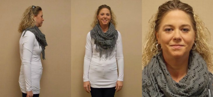 Dr. Keith McEwen MD Indianapolis Indiana Carmel Nobelsville Anderson Hamilton Community Surgery Center Hamilton Community Bariatrics Hamilton 46060 46011 46062 46033 46037 46074 46032 46220 46226 46055 46064 46030 46203 46239 46259 46163 46142 46143 lap-band system lap band system cost lap band system reviews lap band system patient education seminars lap band system access port lap band system pedometer lap band public system lap band ap system mri safety bioenterics lap band system lap-band ap system small lap band system lap-band system allergan lap band ap system large lap band gastric banding system franciscan health system lap band the new lap band system lap band through public system lap band surgery public system lap band system surgery the lap band system lap-band vg system what is lap band systemlap-band procedure lap-band removal lap-band system lap-band cost lap-band weight loss surgery lap-band complications lap-band diet lap-band® lap-band reviews lap-band alternative lap-band lap-band surgery lap-band adjustable gastric banding system lap band and pregnancy lap band australia lap band after gastric bypass lap band az lap band adjustment lap band and alcohol lap band and acid reflux lap band austin a lap band surgery a lap band removing a lap band can lapband be removed is a lap band permanent is a lap band safe is a lap band covered by insurance is a lap band reversible how a lap band works does a lap band work lap band before and after lap band before and after pictures lap band blog lap band before and after pics lap band brisbane lap band bmi lap band birmingham al lap band blockage lap band before and after stories lap band bariatric surgery b-2240 lap band lap band cost without insurance lap band covered by insurance lap band criteria lap band complications years later lap band canada lap band chicago lap band calgary lap band cons realize c lap band clap clap band clap clap bandcamp c section with lap band c-section and lap band surgery c section after lap band hepatitis c and lap band surgery lap band diet menu lap band diet plan lap band dallas lap band diet recipes lap band doctors lap band diet after surgery lap band dance lap band deaths lap band diet without surgery vitamin d deficiency lap band lap band erosion lap band edmonton lap band eligibility lap band erosion causes lap band eating plan lap band erosion lawsuit lap band experiences lap band eating rules lap band esophagus problems lap band erosion complications o que e lap band lap band forum lap band fill lap band failure lap band friendly recipes lap band forum australia lap band failure rate lap band food stuck lap band fill centers lap band failure stories lap band fort worth lap band gal lap band gone wrong lap band gas pain lap band gaining weight back lap band guidelines lap band gurgling noises lap band green zone lap band gallbladder issues lap band good or bad lap band gerd issues lap band houston lap band hypnosis lap band horror stories lap band heartburn and reflux lap band heartburn lap band hypnotherapy lap band houston cost lap band hobart lap band hair loss lap band hernia h pylori lap band lap band insurance lap band issues lap band in mexico lap band information lap band images lap band indiana lap band insurance requirements lap band infection lap band in houston lap band in mexico cost i lap band i want lap band surgery lap band jacksonville fl lap band journey lap band journey blog lap band jackson ms lap band joplin mo lap band joondalup lap band journal lap band jonesboro arkansas lap band jokes lap band juicing j&j lap band lap band kansas city lap band kaiser lap band knoxville tn lap band kelowna lap band killeen texas lap band katy tx lap band kidney stones lap band korea lap band kingsport tn lap band katy lap band lawsuit lap band las vegas lap band liquid diet lap band louisville ky lap band little rock ar lap band leak symptoms lap band lubbock lap band liquid diet recipes lap band long term complications lap band los angeles lap band mexico lap band meal plan lap band miami lap band mri safety lap band melbourne lap band meals lap band macon ga lap band medicare lap band memphis lap band mexico cost u of m lap band surgery lap band not working lap band not losing weight lap band night cough lap band nj lap band nz lap band nyc lap band no surgery lap band no weight loss lap band nausea lap band nutrition guidelines lite n easy lap band lap band or sleeve lap band okc lap band of louisville lap band ontario lap band orlando lap band operation lap band oklahoma lap band ontario cost lap band omaha lap band or sleeve which is better o sign lap band o'brien lap band placer cost of lap band surgery symptoms of lap band erosion removal of lap band dangers of lap band surgery symptoms of lap band slippage complications of lap band surgery complications of lap band cost of lap band removal lap band problems lap band pictures lap band pros and cons lap band pre op diet lap band port lap band price lap band port pain lap band post op diet lap band pregnancy s p lap band lap band qualifications lap band qualifications 2014 lap band qualifications 2015 lap band qualifications 2013 lap band questions lap band questions and answers lap band quiz lap band queensland lap band quick weight loss lap band qld q&a lap band lap band requirements lap band recipes lap band recovery lap band risks lap band results lap band removal recovery lap band removal surgery lap band removal complications lap-band surgery pros and cons lap band surgery cost lap band side effects lap band slippage lap band surgery reviews lap band surgery requirements lap band success stories lap band surgery risks s code for lap band adjustment what is lap band lap band talk lap band toronto lap band to sleeve revision lap band to gastric sleeve lap band testimonials lap band to gastric sleeve revision lap band tulsa lap band tucson lap band to gastric sleeve conversion lap band to sleeve conversion lap band t shirt lap band utah lap band uk lap band utah cost lap band unfill lap band united healthcare lap band ulcer lap band unfilled problems lap band ulcer issues lap band unsuccessful stories lap band upper gi youtube lap band youtube lap band surgery lap band u of m lap band vs sleeve lap band vomiting lap band video lap band vs bypass lap band vomiting after eating lap band vs sleeve 2013 lap band vomiting slime lap band vancouver lap band vs slimband lap band vomiting in sleep gastric bypass v lap band lap band v sleeve lap band weight loss lap band with plication lap band wiki lap band weight loss expectations lap band without surgery lap band weight loss results lap band weight requirements lap band weight loss first month lap band weight loss rate lap band w/plication lap band x ray gastric band x ray lap band slippage x ray slipped lap band x ray lap band position x ray gastric lap band x ray lap band angle x ray lap band surgery x ray x ray of lap band x ray of slipped lap band gas x after lap band lap band youtube lap band youtube video lap band youtube before and after lap band yahoo answers lap band yes or no lap band young adults lap band yuma az lap band years later lap band york pa lap band youtube 2012 lap band zones lap band zephyrhills florida gastric band zones lap band red zone lap band surgery zanesville ohio lap band new zealand lap band cost new zealand zoloft lap band lap band surgery christchurch new zealand gastric band zürich lap band 10 years later lap band 1st fill lap band 1 year later lap band 1 week post op lap band 101 lap band 1 month post-op lap band 18 years old lap band 16 year old lap band 14cc lap band 15 year old 1 800 lap band week 1 lap band diet lap band 2014 lap band 2013 lap band 2 week liquid diet lap band 2015 lap band 20 years old lap band 2 years post-op lap band 2 weeks post op lap band 2 months post op lap band 22 years old lap band 200 lbs week 2 lap band diet 2 year old lap band 2 dangers of lap band surgery 2 years after lap band 2 months after lap band 2 weeks after lap band lap band 2 years later day 2 after lap band lap band 30 pounds overweight lap band 3 weeks post op lap band 3 months post op lap band 3 years post op lap band 3 days post op lap band 35 bmi lap band 3 months later lap band 3 years later lap band 33 bmi lap band 31 bmi stage 3 lap band diet 3 lap joint band clamp week 3 lap band diet phase 3 lap band diet 3 months after lap band 3 days post lap band week 3 post lap band lap band 4 years later lap band 40 pounds overweight lap band 400 lbs lap band 4cc lap band after 4 years lap band for 40 lbs. overweight lap band week 4 allergan lap band 4cc lap band stage 4 diet lap band to lose 40 pounds stage 4 lap band diet 4 years after lap band 4 weeks after lap band lap band 5 years later lap band 5 day pouch test lap band 5 years post op lap band 50 lbs overweight lap band 5 cc fill lap band 5 months post op lap band 5 weeks post-op lap band $5000 lap band 50 pounds overweight lap band 5 day diet stage 5 lap band diet 5 years after lap band 5 days post op lap-band lap band 6 months post op lap band 60 pounds overweight lap band 6 years later lap band 6 cc fill lap band 6 weeks post op lap band 6 month diet lap band after 6 years lap band after 6 months lap band surgery over 60 lap band surgery over 65 6 months after lap band lap band 70 pounds overweight lap band after 7 years lap band surgery 77062 lap band 8 golden rules lap band after 8 years 800 lap band 8 golden rules lap band 8 rules of lap band lap band icd 9 lap band icd-9 code lap band erosion icd 9 lap band removal icd 9 lap band complication icd 9 lap band failure icd 9 slipped lap band icd-9 code 9.75 lap band infected lap band icd 9 icd 9 lap band complications icd 9 lap band icd 9 lap band surgery icd 9 lap band adjustment icd 9 gastric lap band icd 9 failed lap band icd 9 for lap band erosion bariatric banding surgery bariatric band surgery cost bariatric band diet bariatric band slippage bariatric band fills bariatric band complications bariatric band adjustment bariatric band manufacturers bariatric lap band bariatric lap band surgery problems bariatric band bariatric band surgery lap band bariatric surgery stomach band after pregnancy stomach band after c section stomach band as seen on tv stomach band after hysterectomy stomach band and cream to lose weight stomach band alternative stomach band at walmart stomach band and pregnancy stomach band after cesarean bariatric belly band stomach burner band stomach band before and after stomach band belt baby stomach band best stomach band after pregnancy best stomach band ballet stomach band lap band bariatric surgery before after bariatric surgery bypass vs band stomach band cost laparoscopic band complications stomach band covered by insurance stomach band cost canada stomach band canada stomach band cost sydney stomach band cost uk laparoscopic band cost stomach band candidate stomach band during pregnancy stomach band diabetes bariatric lap band diet bariatric surgery lap band diet stomach band exercise stomach band erosion stomach elastic band stomach earth band stomach elastic band surgery' stomach band to lose weight stomach band for working out stomach band for after pregnancy stomach band for pregnancy stomach band for exercise stomach band for acid reflux stomach band for running stomach band for abs stomach band for working out walmart stomach band hypnosis stomach band holster stomach band hypnotherapy stomach heat band stomach band infomercial stomach band in pakistan i-band bariatric surgery stomach band japanese stomach band japan stomach band lose weight stomach lift band lap band bariatric surgery cost lap band bariatric surgery forums lap band vs bariatric surgery bariatric lap band surgery diet bariatric lap band recipes stomach band mexico stomach band modells stomach muscle band stomach monkeys band stomach mouth band stomach band nz stomach band operation stomach band on nhs lap band or bariatric surgery stomach omaha band stomach band procedure stomach band post pregnancy stomach band pregnancy stomach band price stomach band problems laparoscopic band phi angle laparoscopic band placement laparoscopic band port stomach band perth laparoscopic band passer laparoscopic band removal stomach band reviews laparoscopic band radiographics stomach band removal laparoscopic band removal cpt code stomach band requirements stomach band risks stomach band recovery time laparoscopic band radiology laparoscopic band removal cpt bariatric surgery band slip stomach band surgery cost laparoscopic band surgery stomach band surgery risks stomach band surgery cost canada stomach band side effects laparoscopic band surgery cost stomach band to lose belly fat stomach band to lose weight cost stomach band that burns fat stomach band that makes you sweat stomach band to sweat stomach band to lose weight as seen on tv stomach band to workout stomach band toronto stomach band target stomach band uk stomach vibrating band lap band vs sleeve bariatric surgery bariatric sleeve vs band bariatric advantage vitaband stomach band walmart stomach band workout stomach band while working out stomach band wrap stomach band with gel stomach band while exercising stomach band wiki stomach band working out stomach band with lotion stomach band youtube lapbandindiana.com