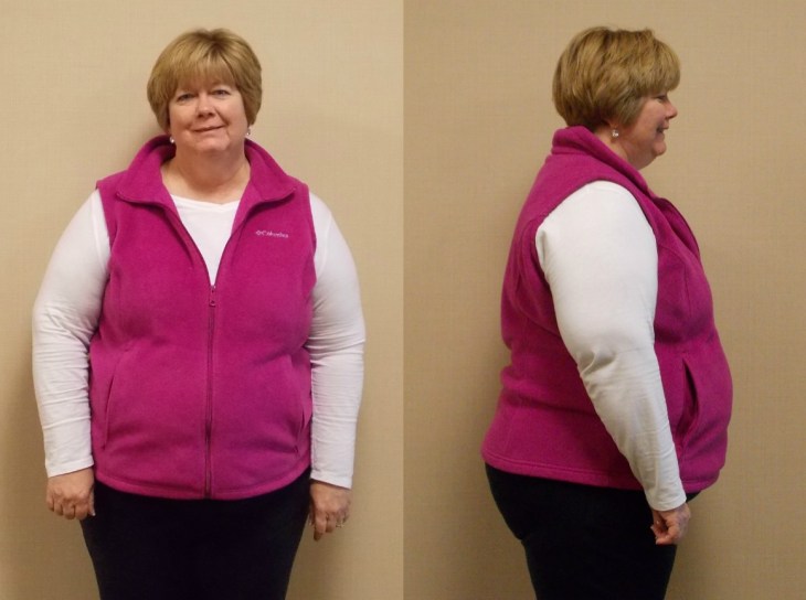 Dr. Keith McEwen MD Indianapolis Indiana Carmel Nobelsville Anderson Hamilton Community Surgery Center Hamilton Community Bariatrics Hamilton 46060 46011 46062 46033 46037 46074 46032 46220 46226 46055 46064 46030 46203 46239 46259 46163 46142 46143 lap-band system lap band system cost lap band system reviews lap band system patient education seminars lap band system access port lap band system pedometer lap band public system lap band ap system mri safety bioenterics lap band system lap-band ap system small lap band system lap-band system allergan lap band ap system large lap band gastric banding system franciscan health system lap band the new lap band system lap band through public system lap band surgery public system lap band system surgery the lap band system lap-band vg system what is lap band systemlap-band procedure lap-band removal lap-band system lap-band cost lap-band weight loss surgery lap-band complications lap-band diet lap-band® lap-band reviews lap-band alternative lap-band lap-band surgery lap-band adjustable gastric banding system lap band and pregnancy lap band australia lap band after gastric bypass lap band az lap band adjustment lap band and alcohol lap band and acid reflux lap band austin a lap band surgery a lap band removing a lap band can lapband be removed is a lap band permanent is a lap band safe is a lap band covered by insurance is a lap band reversible how a lap band works does a lap band work lap band before and after lap band before and after pictures lap band blog lap band before and after pics lap band brisbane lap band bmi lap band birmingham al lap band blockage lap band before and after stories lap band bariatric surgery b-2240 lap band lap band cost without insurance lap band covered by insurance lap band criteria lap band complications years later lap band canada lap band chicago lap band calgary lap band cons realize c lap band clap clap band clap clap bandcamp c section with lap band c-section and lap band surgery c section after lap band hepatitis c and lap band surgery lap band diet menu lap band diet plan lap band dallas lap band diet recipes lap band doctors lap band diet after surgery lap band dance lap band deaths lap band diet without surgery vitamin d deficiency lap band lap band erosion lap band edmonton lap band eligibility lap band erosion causes lap band eating plan lap band erosion lawsuit lap band experiences lap band eating rules lap band esophagus problems lap band erosion complications o que e lap band lap band forum lap band fill lap band failure lap band friendly recipes lap band forum australia lap band failure rate lap band food stuck lap band fill centers lap band failure stories lap band fort worth lap band gal lap band gone wrong lap band gas pain lap band gaining weight back lap band guidelines lap band gurgling noises lap band green zone lap band gallbladder issues lap band good or bad lap band gerd issues lap band houston lap band hypnosis lap band horror stories lap band heartburn and reflux lap band heartburn lap band hypnotherapy lap band houston cost lap band hobart lap band hair loss lap band hernia h pylori lap band lap band insurance lap band issues lap band in mexico lap band information lap band images lap band indiana lap band insurance requirements lap band infection lap band in houston lap band in mexico cost i lap band i want lap band surgery lap band jacksonville fl lap band journey lap band journey blog lap band jackson ms lap band joplin mo lap band joondalup lap band journal lap band jonesboro arkansas lap band jokes lap band juicing j&j lap band lap band kansas city lap band kaiser lap band knoxville tn lap band kelowna lap band killeen texas lap band katy tx lap band kidney stones lap band korea lap band kingsport tn lap band katy lap band lawsuit lap band las vegas lap band liquid diet lap band louisville ky lap band little rock ar lap band leak symptoms lap band lubbock lap band liquid diet recipes lap band long term complications lap band los angeles lap band mexico lap band meal plan lap band miami lap band mri safety lap band melbourne lap band meals lap band macon ga lap band medicare lap band memphis lap band mexico cost u of m lap band surgery lap band not working lap band not losing weight lap band night cough lap band nj lap band nz lap band nyc lap band no surgery lap band no weight loss lap band nausea lap band nutrition guidelines lite n easy lap band lap band or sleeve lap band okc lap band of louisville lap band ontario lap band orlando lap band operation lap band oklahoma lap band ontario cost lap band omaha lap band or sleeve which is better o sign lap band o'brien lap band placer cost of lap band surgery symptoms of lap band erosion removal of lap band dangers of lap band surgery symptoms of lap band slippage complications of lap band surgery complications of lap band cost of lap band removal lap band problems lap band pictures lap band pros and cons lap band pre op diet lap band port lap band price lap band port pain lap band post op diet lap band pregnancy s p lap band lap band qualifications lap band qualifications 2014 lap band qualifications 2015 lap band qualifications 2013 lap band questions lap band questions and answers lap band quiz lap band queensland lap band quick weight loss lap band qld q&a lap band lap band requirements lap band recipes lap band recovery lap band risks lap band results lap band removal recovery lap band removal surgery lap band removal complications lap-band surgery pros and cons lap band surgery cost lap band side effects lap band slippage lap band surgery reviews lap band surgery requirements lap band success stories lap band surgery risks s code for lap band adjustment what is lap band lap band talk lap band toronto lap band to sleeve revision lap band to gastric sleeve lap band testimonials lap band to gastric sleeve revision lap band tulsa lap band tucson lap band to gastric sleeve conversion lap band to sleeve conversion lap band t shirt lap band utah lap band uk lap band utah cost lap band unfill lap band united healthcare lap band ulcer lap band unfilled problems lap band ulcer issues lap band unsuccessful stories lap band upper gi youtube lap band youtube lap band surgery lap band u of m lap band vs sleeve lap band vomiting lap band video lap band vs bypass lap band vomiting after eating lap band vs sleeve 2013 lap band vomiting slime lap band vancouver lap band vs slimband lap band vomiting in sleep gastric bypass v lap band lap band v sleeve lap band weight loss lap band with plication lap band wiki lap band weight loss expectations lap band without surgery lap band weight loss results lap band weight requirements lap band weight loss first month lap band weight loss rate lap band w/plication lap band x ray gastric band x ray lap band slippage x ray slipped lap band x ray lap band position x ray gastric lap band x ray lap band angle x ray lap band surgery x ray x ray of lap band x ray of slipped lap band gas x after lap band lap band youtube lap band youtube video lap band youtube before and after lap band yahoo answers lap band yes or no lap band young adults lap band yuma az lap band years later lap band york pa lap band youtube 2012 lap band zones lap band zephyrhills florida gastric band zones lap band red zone lap band surgery zanesville ohio lap band new zealand lap band cost new zealand zoloft lap band lap band surgery christchurch new zealand gastric band zürich lap band 10 years later lap band 1st fill lap band 1 year later lap band 1 week post op lap band 101 lap band 1 month post-op lap band 18 years old lap band 16 year old lap band 14cc lap band 15 year old 1 800 lap band week 1 lap band diet lap band 2014 lap band 2013 lap band 2 week liquid diet lap band 2015 lap band 20 years old lap band 2 years post-op lap band 2 weeks post op lap band 2 months post op lap band 22 years old lap band 200 lbs week 2 lap band diet 2 year old lap band 2 dangers of lap band surgery 2 years after lap band 2 months after lap band 2 weeks after lap band lap band 2 years later day 2 after lap band lap band 30 pounds overweight lap band 3 weeks post op lap band 3 months post op lap band 3 years post op lap band 3 days post op lap band 35 bmi lap band 3 months later lap band 3 years later lap band 33 bmi lap band 31 bmi stage 3 lap band diet 3 lap joint band clamp week 3 lap band diet phase 3 lap band diet 3 months after lap band 3 days post lap band week 3 post lap band lap band 4 years later lap band 40 pounds overweight lap band 400 lbs lap band 4cc lap band after 4 years lap band for 40 lbs. overweight lap band week 4 allergan lap band 4cc lap band stage 4 diet lap band to lose 40 pounds stage 4 lap band diet 4 years after lap band 4 weeks after lap band lap band 5 years later lap band 5 day pouch test lap band 5 years post op lap band 50 lbs overweight lap band 5 cc fill lap band 5 months post op lap band 5 weeks post-op lap band $5000 lap band 50 pounds overweight lap band 5 day diet stage 5 lap band diet 5 years after lap band 5 days post op lap-band lap band 6 months post op lap band 60 pounds overweight lap band 6 years later lap band 6 cc fill lap band 6 weeks post op lap band 6 month diet lap band after 6 years lap band after 6 months lap band surgery over 60 lap band surgery over 65 6 months after lap band lap band 70 pounds overweight lap band after 7 years lap band surgery 77062 lap band 8 golden rules lap band after 8 years 800 lap band 8 golden rules lap band 8 rules of lap band lap band icd 9 lap band icd-9 code lap band erosion icd 9 lap band removal icd 9 lap band complication icd 9 lap band failure icd 9 slipped lap band icd-9 code 9.75 lap band infected lap band icd 9 icd 9 lap band complications icd 9 lap band icd 9 lap band surgery icd 9 lap band adjustment icd 9 gastric lap band icd 9 failed lap band icd 9 for lap band erosion bariatric banding surgery bariatric band surgery cost bariatric band diet bariatric band slippage bariatric band fills bariatric band complications bariatric band adjustment bariatric band manufacturers bariatric lap band bariatric lap band surgery problems bariatric band bariatric band surgery lap band bariatric surgery stomach band after pregnancy stomach band after c section stomach band as seen on tv stomach band after hysterectomy stomach band and cream to lose weight stomach band alternative stomach band at walmart stomach band and pregnancy stomach band after cesarean bariatric belly band stomach burner band stomach band before and after stomach band belt baby stomach band best stomach band after pregnancy best stomach band ballet stomach band lap band bariatric surgery before after bariatric surgery bypass vs band stomach band cost laparoscopic band complications stomach band covered by insurance stomach band cost canada stomach band canada stomach band cost sydney stomach band cost uk laparoscopic band cost stomach band candidate stomach band during pregnancy stomach band diabetes bariatric lap band diet bariatric surgery lap band diet stomach band exercise stomach band erosion stomach elastic band stomach earth band stomach elastic band surgery' stomach band to lose weight stomach band for working out stomach band for after pregnancy stomach band for pregnancy stomach band for exercise stomach band for acid reflux stomach band for running stomach band for abs stomach band for working out walmart stomach band hypnosis stomach band holster stomach band hypnotherapy stomach heat band stomach band infomercial stomach band in pakistan i-band bariatric surgery stomach band japanese stomach band japan stomach band lose weight stomach lift band lap band bariatric surgery cost lap band bariatric surgery forums lap band vs bariatric surgery bariatric lap band surgery diet bariatric lap band recipes stomach band mexico stomach band modells stomach muscle band stomach monkeys band stomach mouth band stomach band nz stomach band operation stomach band on nhs lap band or bariatric surgery stomach omaha band stomach band procedure stomach band post pregnancy stomach band pregnancy stomach band price stomach band problems laparoscopic band phi angle laparoscopic band placement laparoscopic band port stomach band perth laparoscopic band passer laparoscopic band removal stomach band reviews laparoscopic band radiographics stomach band removal laparoscopic band removal cpt code stomach band requirements stomach band risks stomach band recovery time laparoscopic band radiology laparoscopic band removal cpt bariatric surgery band slip stomach band surgery cost laparoscopic band surgery stomach band surgery risks stomach band surgery cost canada stomach band side effects laparoscopic band surgery cost stomach band to lose belly fat stomach band to lose weight cost stomach band that burns fat stomach band that makes you sweat stomach band to sweat stomach band to lose weight as seen on tv stomach band to workout stomach band toronto stomach band target stomach band uk stomach vibrating band lap band vs sleeve bariatric surgery bariatric sleeve vs band bariatric advantage vitaband stomach band walmart stomach band workout stomach band while working out stomach band wrap stomach band with gel stomach band while exercising stomach band wiki stomach band working out stomach band with lotion stomach band youtube lapbandindiana.com