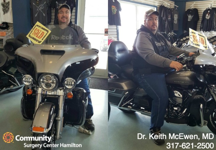 Dr. Keith McEwen MD Indianapolis Indiana Carmel Nobelsville Anderson Hamilton Community Surgery Center Hamilton Community Bariatrics Hamilton 46060 46011 46062 46033 46037 46074 46032 46220 46226 46055 46064 46030 46203 46239 46259 46163 46142 46143 lap-band system lap band system cost lap band system reviews lap band system patient education seminars lap band system access port lap band system pedometer lap band public system lap band ap system mri safety bioenterics lap band system lap-band ap system small lap band system lap-band system allergan lap band ap system large lap band gastric banding system franciscan health system lap band the new lap band system lap band through public system lap band surgery public system lap band system surgery the lap band system lap-band vg system what is lap band systemlap-band procedure lap-band removal lap-band system lap-band cost lap-band weight loss surgery lap-band complications lap-band diet lap-band® lap-band reviews lap-band alternative lap-band lap-band surgery lap-band adjustable gastric banding system lap band and pregnancy lap band australia lap band after gastric bypass lap band az lap band adjustment lap band and alcohol lap band and acid reflux lap band austin a lap band surgery a lap band removing a lap band can lapband be removed is a lap band permanent is a lap band safe is a lap band covered by insurance is a lap band reversible how a lap band works does a lap band work lap band before and after lap band before and after pictures lap band blog lap band before and after pics lap band brisbane lap band bmi lap band birmingham al lap band blockage lap band before and after stories lap band bariatric surgery b-2240 lap band lap band cost without insurance lap band covered by insurance lap band criteria lap band complications years later lap band canada lap band chicago lap band calgary lap band cons realize c lap band clap clap band clap clap bandcamp c section with lap band c-section and lap band surgery c section after lap band hepatitis c and lap band surgery lap band diet menu lap band diet plan lap band dallas lap band diet recipes lap band doctors lap band diet after surgery lap band dance lap band deaths lap band diet without surgery vitamin d deficiency lap band lap band erosion lap band edmonton lap band eligibility lap band erosion causes lap band eating plan lap band erosion lawsuit lap band experiences lap band eating rules lap band esophagus problems lap band erosion complications o que e lap band lap band forum lap band fill lap band failure lap band friendly recipes lap band forum australia lap band failure rate lap band food stuck lap band fill centers lap band failure stories lap band fort worth lap band gal lap band gone wrong lap band gas pain lap band gaining weight back lap band guidelines lap band gurgling noises lap band green zone lap band gallbladder issues lap band good or bad lap band gerd issues lap band houston lap band hypnosis lap band horror stories lap band heartburn and reflux lap band heartburn lap band hypnotherapy lap band houston cost lap band hobart lap band hair loss lap band hernia h pylori lap band lap band insurance lap band issues lap band in mexico lap band information lap band images lap band indiana lap band insurance requirements lap band infection lap band in houston lap band in mexico cost i lap band i want lap band surgery lap band jacksonville fl lap band journey lap band journey blog lap band jackson ms lap band joplin mo lap band joondalup lap band journal lap band jonesboro arkansas lap band jokes lap band juicing j&j lap band lap band kansas city lap band kaiser lap band knoxville tn lap band kelowna lap band killeen texas lap band katy tx lap band kidney stones lap band korea lap band kingsport tn lap band katy lap band lawsuit lap band las vegas lap band liquid diet lap band louisville ky lap band little rock ar lap band leak symptoms lap band lubbock lap band liquid diet recipes lap band long term complications lap band los angeles lap band mexico lap band meal plan lap band miami lap band mri safety lap band melbourne lap band meals lap band macon ga lap band medicare lap band memphis lap band mexico cost u of m lap band surgery lap band not working lap band not losing weight lap band night cough lap band nj lap band nz lap band nyc lap band no surgery lap band no weight loss lap band nausea lap band nutrition guidelines lite n easy lap band lap band or sleeve lap band okc lap band of louisville lap band ontario lap band orlando lap band operation lap band oklahoma lap band ontario cost lap band omaha lap band or sleeve which is better o sign lap band o'brien lap band placer cost of lap band surgery symptoms of lap band erosion removal of lap band dangers of lap band surgery symptoms of lap band slippage complications of lap band surgery complications of lap band cost of lap band removal lap band problems lap band pictures lap band pros and cons lap band pre op diet lap band port lap band price lap band port pain lap band post op diet lap band pregnancy s p lap band lap band qualifications lap band qualifications 2014 lap band qualifications 2015 lap band qualifications 2013 lap band questions lap band questions and answers lap band quiz lap band queensland lap band quick weight loss lap band qld q&a lap band lap band requirements lap band recipes lap band recovery lap band risks lap band results lap band removal recovery lap band removal surgery lap band removal complications lap-band surgery pros and cons lap band surgery cost lap band side effects lap band slippage lap band surgery reviews lap band surgery requirements lap band success stories lap band surgery risks s code for lap band adjustment what is lap band lap band talk lap band toronto lap band to sleeve revision lap band to gastric sleeve lap band testimonials lap band to gastric sleeve revision lap band tulsa lap band tucson lap band to gastric sleeve conversion lap band to sleeve conversion lap band t shirt lap band utah lap band uk lap band utah cost lap band unfill lap band united healthcare lap band ulcer lap band unfilled problems lap band ulcer issues lap band unsuccessful stories lap band upper gi youtube lap band youtube lap band surgery lap band u of m lap band vs sleeve lap band vomiting lap band video lap band vs bypass lap band vomiting after eating lap band vs sleeve 2013 lap band vomiting slime lap band vancouver lap band vs slimband lap band vomiting in sleep gastric bypass v lap band lap band v sleeve lap band weight loss lap band with plication lap band wiki lap band weight loss expectations lap band without surgery lap band weight loss results lap band weight requirements lap band weight loss first month lap band weight loss rate lap band w/plication lap band x ray gastric band x ray lap band slippage x ray slipped lap band x ray lap band position x ray gastric lap band x ray lap band angle x ray lap band surgery x ray x ray of lap band x ray of slipped lap band gas x after lap band lap band youtube lap band youtube video lap band youtube before and after lap band yahoo answers lap band yes or no lap band young adults lap band yuma az lap band years later lap band york pa lap band youtube 2012 lap band zones lap band zephyrhills florida gastric band zones lap band red zone lap band surgery zanesville ohio lap band new zealand lap band cost new zealand zoloft lap band lap band surgery christchurch new zealand gastric band zürich lap band 10 years later lap band 1st fill lap band 1 year later lap band 1 week post op lap band 101 lap band 1 month post-op lap band 18 years old lap band 16 year old lap band 14cc lap band 15 year old 1 800 lap band week 1 lap band diet lap band 2014 lap band 2013 lap band 2 week liquid diet lap band 2015 lap band 20 years old lap band 2 years post-op lap band 2 weeks post op lap band 2 months post op lap band 22 years old lap band 200 lbs week 2 lap band diet 2 year old lap band 2 dangers of lap band surgery 2 years after lap band 2 months after lap band 2 weeks after lap band lap band 2 years later day 2 after lap band lap band 30 pounds overweight lap band 3 weeks post op lap band 3 months post op lap band 3 years post op lap band 3 days post op lap band 35 bmi lap band 3 months later lap band 3 years later lap band 33 bmi lap band 31 bmi stage 3 lap band diet 3 lap joint band clamp week 3 lap band diet phase 3 lap band diet 3 months after lap band 3 days post lap band week 3 post lap band lap band 4 years later lap band 40 pounds overweight lap band 400 lbs lap band 4cc lap band after 4 years lap band for 40 lbs. overweight lap band week 4 allergan lap band 4cc lap band stage 4 diet lap band to lose 40 pounds stage 4 lap band diet 4 years after lap band 4 weeks after lap band lap band 5 years later lap band 5 day pouch test lap band 5 years post op lap band 50 lbs overweight lap band 5 cc fill lap band 5 months post op lap band 5 weeks post-op lap band $5000 lap band 50 pounds overweight lap band 5 day diet stage 5 lap band diet 5 years after lap band 5 days post op lap-band lap band 6 months post op lap band 60 pounds overweight lap band 6 years later lap band 6 cc fill lap band 6 weeks post op lap band 6 month diet lap band after 6 years lap band after 6 months lap band surgery over 60 lap band surgery over 65 6 months after lap band lap band 70 pounds overweight lap band after 7 years lap band surgery 77062 lap band 8 golden rules lap band after 8 years 800 lap band 8 golden rules lap band 8 rules of lap band lap band icd 9 lap band icd-9 code lap band erosion icd 9 lap band removal icd 9 lap band complication icd 9 lap band failure icd 9 slipped lap band icd-9 code 9.75 lap band infected lap band icd 9 icd 9 lap band complications icd 9 lap band icd 9 lap band surgery icd 9 lap band adjustment icd 9 gastric lap band icd 9 failed lap band icd 9 for lap band erosion bariatric banding surgery bariatric band surgery cost bariatric band diet bariatric band slippage bariatric band fills bariatric band complications bariatric band adjustment bariatric band manufacturers bariatric lap band bariatric lap band surgery problems bariatric band bariatric band surgery lap band bariatric surgery stomach band after pregnancy stomach band after c section stomach band as seen on tv stomach band after hysterectomy stomach band and cream to lose weight stomach band alternative stomach band at walmart stomach band and pregnancy stomach band after cesarean bariatric belly band stomach burner band stomach band before and after stomach band belt baby stomach band best stomach band after pregnancy best stomach band ballet stomach band lap band bariatric surgery before after bariatric surgery bypass vs band stomach band cost laparoscopic band complications stomach band covered by insurance stomach band cost canada stomach band canada stomach band cost sydney stomach band cost uk laparoscopic band cost stomach band candidate stomach band during pregnancy stomach band diabetes bariatric lap band diet bariatric surgery lap band diet stomach band exercise stomach band erosion stomach elastic band stomach earth band stomach elastic band surgery' stomach band to lose weight stomach band for working out stomach band for after pregnancy stomach band for pregnancy stomach band for exercise stomach band for acid reflux stomach band for running stomach band for abs stomach band for working out walmart stomach band hypnosis stomach band holster stomach band hypnotherapy stomach heat band stomach band infomercial stomach band in pakistan i-band bariatric surgery stomach band japanese stomach band japan stomach band lose weight stomach lift band lap band bariatric surgery cost lap band bariatric surgery forums lap band vs bariatric surgery bariatric lap band surgery diet bariatric lap band recipes stomach band mexico stomach band modells stomach muscle band stomach monkeys band stomach mouth band stomach band nz stomach band operation stomach band on nhs lap band or bariatric surgery stomach omaha band stomach band procedure stomach band post pregnancy stomach band pregnancy stomach band price stomach band problems laparoscopic band phi angle laparoscopic band placement laparoscopic band port stomach band perth laparoscopic band passer laparoscopic band removal stomach band reviews laparoscopic band radiographics stomach band removal laparoscopic band removal cpt code stomach band requirements stomach band risks stomach band recovery time laparoscopic band radiology laparoscopic band removal cpt bariatric surgery band slip stomach band surgery cost laparoscopic band surgery stomach band surgery risks stomach band surgery cost canada stomach band side effects laparoscopic band surgery cost stomach band to lose belly fat stomach band to lose weight cost stomach band that burns fat stomach band that makes you sweat stomach band to sweat stomach band to lose weight as seen on tv stomach band to workout stomach band toronto stomach band target stomach band uk stomach vibrating band lap band vs sleeve bariatric surgery bariatric sleeve vs band bariatric advantage vitaband stomach band walmart stomach band workout stomach band while working out stomach band wrap stomach band with gel stomach band while exercising stomach band wiki stomach band working out stomach band with lotion stomach band youtube lapbandindiana.com