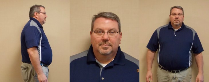 Dr. Keith McEwen MD Indianapolis Indiana Carmel Nobelsville Anderson Hamilton Community Surgery Center Hamilton Community Bariatrics Hamilton 46060 46011 46062 46033 46037 46074 46032 46220 46226 46055 46064 46030 46203 46239 46259 46163 46142 46143 lap-band system lap band system cost lap band system reviews lap band system patient education seminars lap band system access port lap band system pedometer lap band public system lap band ap system mri safety bioenterics lap band system lap-band ap system small lap band system lap-band system allergan lap band ap system large lap band gastric banding system franciscan health system lap band the new lap band system lap band through public system lap band surgery public system lap band system surgery the lap band system lap-band vg system what is lap band systemlap-band procedure lap-band removal lap-band system lap-band cost lap-band weight loss surgery lap-band complications lap-band diet lap-band® lap-band reviews lap-band alternative lap-band lap-band surgery lap-band adjustable gastric banding system lap band and pregnancy lap band australia lap band after gastric bypass lap band az lap band adjustment lap band and alcohol lap band and acid reflux lap band austin a lap band surgery a lap band removing a lap band can lapband be removed is a lap band permanent is a lap band safe is a lap band covered by insurance is a lap band reversible how a lap band works does a lap band work lap band before and after lap band before and after pictures lap band blog lap band before and after pics lap band brisbane lap band bmi lap band birmingham al lap band blockage lap band before and after stories lap band bariatric surgery b-2240 lap band lap band cost without insurance lap band covered by insurance lap band criteria lap band complications years later lap band canada lap band chicago lap band calgary lap band cons realize c lap band clap clap band clap clap bandcamp c section with lap band c-section and lap band surgery c section after lap band hepatitis c and lap band surgery lap band diet menu lap band diet plan lap band dallas lap band diet recipes lap band doctors lap band diet after surgery lap band dance lap band deaths lap band diet without surgery vitamin d deficiency lap band lap band erosion lap band edmonton lap band eligibility lap band erosion causes lap band eating plan lap band erosion lawsuit lap band experiences lap band eating rules lap band esophagus problems lap band erosion complications o que e lap band lap band forum lap band fill lap band failure lap band friendly recipes lap band forum australia lap band failure rate lap band food stuck lap band fill centers lap band failure stories lap band fort worth lap band gal lap band gone wrong lap band gas pain lap band gaining weight back lap band guidelines lap band gurgling noises lap band green zone lap band gallbladder issues lap band good or bad lap band gerd issues lap band houston lap band hypnosis lap band horror stories lap band heartburn and reflux lap band heartburn lap band hypnotherapy lap band houston cost lap band hobart lap band hair loss lap band hernia h pylori lap band lap band insurance lap band issues lap band in mexico lap band information lap band images lap band indiana lap band insurance requirements lap band infection lap band in houston lap band in mexico cost i lap band i want lap band surgery lap band jacksonville fl lap band journey lap band journey blog lap band jackson ms lap band joplin mo lap band joondalup lap band journal lap band jonesboro arkansas lap band jokes lap band juicing j&j lap band lap band kansas city lap band kaiser lap band knoxville tn lap band kelowna lap band killeen texas lap band katy tx lap band kidney stones lap band korea lap band kingsport tn lap band katy lap band lawsuit lap band las vegas lap band liquid diet lap band louisville ky lap band little rock ar lap band leak symptoms lap band lubbock lap band liquid diet recipes lap band long term complications lap band los angeles lap band mexico lap band meal plan lap band miami lap band mri safety lap band melbourne lap band meals lap band macon ga lap band medicare lap band memphis lap band mexico cost u of m lap band surgery lap band not working lap band not losing weight lap band night cough lap band nj lap band nz lap band nyc lap band no surgery lap band no weight loss lap band nausea lap band nutrition guidelines lite n easy lap band lap band or sleeve lap band okc lap band of louisville lap band ontario lap band orlando lap band operation lap band oklahoma lap band ontario cost lap band omaha lap band or sleeve which is better o sign lap band o'brien lap band placer cost of lap band surgery symptoms of lap band erosion removal of lap band dangers of lap band surgery symptoms of lap band slippage complications of lap band surgery complications of lap band cost of lap band removal lap band problems lap band pictures lap band pros and cons lap band pre op diet lap band port lap band price lap band port pain lap band post op diet lap band pregnancy s p lap band lap band qualifications lap band qualifications 2014 lap band qualifications 2015 lap band qualifications 2013 lap band questions lap band questions and answers lap band quiz lap band queensland lap band quick weight loss lap band qld q&a lap band lap band requirements lap band recipes lap band recovery lap band risks lap band results lap band removal recovery lap band removal surgery lap band removal complications lap-band surgery pros and cons lap band surgery cost lap band side effects lap band slippage lap band surgery reviews lap band surgery requirements lap band success stories lap band surgery risks s code for lap band adjustment what is lap band lap band talk lap band toronto lap band to sleeve revision lap band to gastric sleeve lap band testimonials lap band to gastric sleeve revision lap band tulsa lap band tucson lap band to gastric sleeve conversion lap band to sleeve conversion lap band t shirt lap band utah lap band uk lap band utah cost lap band unfill lap band united healthcare lap band ulcer lap band unfilled problems lap band ulcer issues lap band unsuccessful stories lap band upper gi youtube lap band youtube lap band surgery lap band u of m lap band vs sleeve lap band vomiting lap band video lap band vs bypass lap band vomiting after eating lap band vs sleeve 2013 lap band vomiting slime lap band vancouver lap band vs slimband lap band vomiting in sleep gastric bypass v lap band lap band v sleeve lap band weight loss lap band with plication lap band wiki lap band weight loss expectations lap band without surgery lap band weight loss results lap band weight requirements lap band weight loss first month lap band weight loss rate lap band w/plication lap band x ray gastric band x ray lap band slippage x ray slipped lap band x ray lap band position x ray gastric lap band x ray lap band angle x ray lap band surgery x ray x ray of lap band x ray of slipped lap band gas x after lap band lap band youtube lap band youtube video lap band youtube before and after lap band yahoo answers lap band yes or no lap band young adults lap band yuma az lap band years later lap band york pa lap band youtube 2012 lap band zones lap band zephyrhills florida gastric band zones lap band red zone lap band surgery zanesville ohio lap band new zealand lap band cost new zealand zoloft lap band lap band surgery christchurch new zealand gastric band zürich lap band 10 years later lap band 1st fill lap band 1 year later lap band 1 week post op lap band 101 lap band 1 month post-op lap band 18 years old lap band 16 year old lap band 14cc lap band 15 year old 1 800 lap band week 1 lap band diet lap band 2014 lap band 2013 lap band 2 week liquid diet lap band 2015 lap band 20 years old lap band 2 years post-op lap band 2 weeks post op lap band 2 months post op lap band 22 years old lap band 200 lbs week 2 lap band diet 2 year old lap band 2 dangers of lap band surgery 2 years after lap band 2 months after lap band 2 weeks after lap band lap band 2 years later day 2 after lap band lap band 30 pounds overweight lap band 3 weeks post op lap band 3 months post op lap band 3 years post op lap band 3 days post op lap band 35 bmi lap band 3 months later lap band 3 years later lap band 33 bmi lap band 31 bmi stage 3 lap band diet 3 lap joint band clamp week 3 lap band diet phase 3 lap band diet 3 months after lap band 3 days post lap band week 3 post lap band lap band 4 years later lap band 40 pounds overweight lap band 400 lbs lap band 4cc lap band after 4 years lap band for 40 lbs. overweight lap band week 4 allergan lap band 4cc lap band stage 4 diet lap band to lose 40 pounds stage 4 lap band diet 4 years after lap band 4 weeks after lap band lap band 5 years later lap band 5 day pouch test lap band 5 years post op lap band 50 lbs overweight lap band 5 cc fill lap band 5 months post op lap band 5 weeks post-op lap band $5000 lap band 50 pounds overweight lap band 5 day diet stage 5 lap band diet 5 years after lap band 5 days post op lap-band lap band 6 months post op lap band 60 pounds overweight lap band 6 years later lap band 6 cc fill lap band 6 weeks post op lap band 6 month diet lap band after 6 years lap band after 6 months lap band surgery over 60 lap band surgery over 65 6 months after lap band lap band 70 pounds overweight lap band after 7 years lap band surgery 77062 lap band 8 golden rules lap band after 8 years 800 lap band 8 golden rules lap band 8 rules of lap band lap band icd 9 lap band icd-9 code lap band erosion icd 9 lap band removal icd 9 lap band complication icd 9 lap band failure icd 9 slipped lap band icd-9 code 9.75 lap band infected lap band icd 9 icd 9 lap band complications icd 9 lap band icd 9 lap band surgery icd 9 lap band adjustment icd 9 gastric lap band icd 9 failed lap band icd 9 for lap band erosion bariatric banding surgery bariatric band surgery cost bariatric band diet bariatric band slippage bariatric band fills bariatric band complications bariatric band adjustment bariatric band manufacturers bariatric lap band bariatric lap band surgery problems bariatric band bariatric band surgery lap band bariatric surgery stomach band after pregnancy stomach band after c section stomach band as seen on tv stomach band after hysterectomy stomach band and cream to lose weight stomach band alternative stomach band at walmart stomach band and pregnancy stomach band after cesarean bariatric belly band stomach burner band stomach band before and after stomach band belt baby stomach band best stomach band after pregnancy best stomach band ballet stomach band lap band bariatric surgery before after bariatric surgery bypass vs band stomach band cost laparoscopic band complications stomach band covered by insurance stomach band cost canada stomach band canada stomach band cost sydney stomach band cost uk laparoscopic band cost stomach band candidate stomach band during pregnancy stomach band diabetes bariatric lap band diet bariatric surgery lap band diet stomach band exercise stomach band erosion stomach elastic band stomach earth band stomach elastic band surgery' stomach band to lose weight stomach band for working out stomach band for after pregnancy stomach band for pregnancy stomach band for exercise stomach band for acid reflux stomach band for running stomach band for abs stomach band for working out walmart stomach band hypnosis stomach band holster stomach band hypnotherapy stomach heat band stomach band infomercial stomach band in pakistan i-band bariatric surgery stomach band japanese stomach band japan stomach band lose weight stomach lift band lap band bariatric surgery cost lap band bariatric surgery forums lap band vs bariatric surgery bariatric lap band surgery diet bariatric lap band recipes stomach band mexico stomach band modells stomach muscle band stomach monkeys band stomach mouth band stomach band nz stomach band operation stomach band on nhs lap band or bariatric surgery stomach omaha band stomach band procedure stomach band post pregnancy stomach band pregnancy stomach band price stomach band problems laparoscopic band phi angle laparoscopic band placement laparoscopic band port stomach band perth laparoscopic band passer laparoscopic band removal stomach band reviews laparoscopic band radiographics stomach band removal laparoscopic band removal cpt code stomach band requirements stomach band risks stomach band recovery time laparoscopic band radiology laparoscopic band removal cpt bariatric surgery band slip stomach band surgery cost laparoscopic band surgery stomach band surgery risks stomach band surgery cost canada stomach band side effects laparoscopic band surgery cost stomach band to lose belly fat stomach band to lose weight cost stomach band that burns fat stomach band that makes you sweat stomach band to sweat stomach band to lose weight as seen on tv stomach band to workout stomach band toronto stomach band target stomach band uk stomach vibrating band lap band vs sleeve bariatric surgery bariatric sleeve vs band bariatric advantage vitaband stomach band walmart stomach band workout stomach band while working out stomach band wrap stomach band with gel stomach band while exercising stomach band wiki stomach band working out stomach band with lotion stomach band youtube lapbandindiana.com