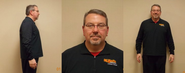 Dr. Keith McEwen MD Indianapolis Indiana Carmel Nobelsville Anderson Hamilton Community Surgery Center Hamilton Community Bariatrics Hamilton 46060 46011 46062 46033 46037 46074 46032 46220 46226 46055 46064 46030 46203 46239 46259 46163 46142 46143 lap-band system lap band system cost lap band system reviews lap band system patient education seminars lap band system access port lap band system pedometer lap band public system lap band ap system mri safety bioenterics lap band system lap-band ap system small lap band system lap-band system allergan lap band ap system large lap band gastric banding system franciscan health system lap band the new lap band system lap band through public system lap band surgery public system lap band system surgery the lap band system lap-band vg system what is lap band systemlap-band procedure lap-band removal lap-band system lap-band cost lap-band weight loss surgery lap-band complications lap-band diet lap-band® lap-band reviews lap-band alternative lap-band lap-band surgery lap-band adjustable gastric banding system lap band and pregnancy lap band australia lap band after gastric bypass lap band az lap band adjustment lap band and alcohol lap band and acid reflux lap band austin a lap band surgery a lap band removing a lap band can lapband be removed is a lap band permanent is a lap band safe is a lap band covered by insurance is a lap band reversible how a lap band works does a lap band work lap band before and after lap band before and after pictures lap band blog lap band before and after pics lap band brisbane lap band bmi lap band birmingham al lap band blockage lap band before and after stories lap band bariatric surgery b-2240 lap band lap band cost without insurance lap band covered by insurance lap band criteria lap band complications years later lap band canada lap band chicago lap band calgary lap band cons realize c lap band clap clap band clap clap bandcamp c section with lap band c-section and lap band surgery c section after lap band hepatitis c and lap band surgery lap band diet menu lap band diet plan lap band dallas lap band diet recipes lap band doctors lap band diet after surgery lap band dance lap band deaths lap band diet without surgery vitamin d deficiency lap band lap band erosion lap band edmonton lap band eligibility lap band erosion causes lap band eating plan lap band erosion lawsuit lap band experiences lap band eating rules lap band esophagus problems lap band erosion complications o que e lap band lap band forum lap band fill lap band failure lap band friendly recipes lap band forum australia lap band failure rate lap band food stuck lap band fill centers lap band failure stories lap band fort worth lap band gal lap band gone wrong lap band gas pain lap band gaining weight back lap band guidelines lap band gurgling noises lap band green zone lap band gallbladder issues lap band good or bad lap band gerd issues lap band houston lap band hypnosis lap band horror stories lap band heartburn and reflux lap band heartburn lap band hypnotherapy lap band houston cost lap band hobart lap band hair loss lap band hernia h pylori lap band lap band insurance lap band issues lap band in mexico lap band information lap band images lap band indiana lap band insurance requirements lap band infection lap band in houston lap band in mexico cost i lap band i want lap band surgery lap band jacksonville fl lap band journey lap band journey blog lap band jackson ms lap band joplin mo lap band joondalup lap band journal lap band jonesboro arkansas lap band jokes lap band juicing j&j lap band lap band kansas city lap band kaiser lap band knoxville tn lap band kelowna lap band killeen texas lap band katy tx lap band kidney stones lap band korea lap band kingsport tn lap band katy lap band lawsuit lap band las vegas lap band liquid diet lap band louisville ky lap band little rock ar lap band leak symptoms lap band lubbock lap band liquid diet recipes lap band long term complications lap band los angeles lap band mexico lap band meal plan lap band miami lap band mri safety lap band melbourne lap band meals lap band macon ga lap band medicare lap band memphis lap band mexico cost u of m lap band surgery lap band not working lap band not losing weight lap band night cough lap band nj lap band nz lap band nyc lap band no surgery lap band no weight loss lap band nausea lap band nutrition guidelines lite n easy lap band lap band or sleeve lap band okc lap band of louisville lap band ontario lap band orlando lap band operation lap band oklahoma lap band ontario cost lap band omaha lap band or sleeve which is better o sign lap band o'brien lap band placer cost of lap band surgery symptoms of lap band erosion removal of lap band dangers of lap band surgery symptoms of lap band slippage complications of lap band surgery complications of lap band cost of lap band removal lap band problems lap band pictures lap band pros and cons lap band pre op diet lap band port lap band price lap band port pain lap band post op diet lap band pregnancy s p lap band lap band qualifications lap band qualifications 2014 lap band qualifications 2015 lap band qualifications 2013 lap band questions lap band questions and answers lap band quiz lap band queensland lap band quick weight loss lap band qld q&a lap band lap band requirements lap band recipes lap band recovery lap band risks lap band results lap band removal recovery lap band removal surgery lap band removal complications lap-band surgery pros and cons lap band surgery cost lap band side effects lap band slippage lap band surgery reviews lap band surgery requirements lap band success stories lap band surgery risks s code for lap band adjustment what is lap band lap band talk lap band toronto lap band to sleeve revision lap band to gastric sleeve lap band testimonials lap band to gastric sleeve revision lap band tulsa lap band tucson lap band to gastric sleeve conversion lap band to sleeve conversion lap band t shirt lap band utah lap band uk lap band utah cost lap band unfill lap band united healthcare lap band ulcer lap band unfilled problems lap band ulcer issues lap band unsuccessful stories lap band upper gi youtube lap band youtube lap band surgery lap band u of m lap band vs sleeve lap band vomiting lap band video lap band vs bypass lap band vomiting after eating lap band vs sleeve 2013 lap band vomiting slime lap band vancouver lap band vs slimband lap band vomiting in sleep gastric bypass v lap band lap band v sleeve lap band weight loss lap band with plication lap band wiki lap band weight loss expectations lap band without surgery lap band weight loss results lap band weight requirements lap band weight loss first month lap band weight loss rate lap band w/plication lap band x ray gastric band x ray lap band slippage x ray slipped lap band x ray lap band position x ray gastric lap band x ray lap band angle x ray lap band surgery x ray x ray of lap band x ray of slipped lap band gas x after lap band lap band youtube lap band youtube video lap band youtube before and after lap band yahoo answers lap band yes or no lap band young adults lap band yuma az lap band years later lap band york pa lap band youtube 2012 lap band zones lap band zephyrhills florida gastric band zones lap band red zone lap band surgery zanesville ohio lap band new zealand lap band cost new zealand zoloft lap band lap band surgery christchurch new zealand gastric band zürich lap band 10 years later lap band 1st fill lap band 1 year later lap band 1 week post op lap band 101 lap band 1 month post-op lap band 18 years old lap band 16 year old lap band 14cc lap band 15 year old 1 800 lap band week 1 lap band diet lap band 2014 lap band 2013 lap band 2 week liquid diet lap band 2015 lap band 20 years old lap band 2 years post-op lap band 2 weeks post op lap band 2 months post op lap band 22 years old lap band 200 lbs week 2 lap band diet 2 year old lap band 2 dangers of lap band surgery 2 years after lap band 2 months after lap band 2 weeks after lap band lap band 2 years later day 2 after lap band lap band 30 pounds overweight lap band 3 weeks post op lap band 3 months post op lap band 3 years post op lap band 3 days post op lap band 35 bmi lap band 3 months later lap band 3 years later lap band 33 bmi lap band 31 bmi stage 3 lap band diet 3 lap joint band clamp week 3 lap band diet phase 3 lap band diet 3 months after lap band 3 days post lap band week 3 post lap band lap band 4 years later lap band 40 pounds overweight lap band 400 lbs lap band 4cc lap band after 4 years lap band for 40 lbs. overweight lap band week 4 allergan lap band 4cc lap band stage 4 diet lap band to lose 40 pounds stage 4 lap band diet 4 years after lap band 4 weeks after lap band lap band 5 years later lap band 5 day pouch test lap band 5 years post op lap band 50 lbs overweight lap band 5 cc fill lap band 5 months post op lap band 5 weeks post-op lap band $5000 lap band 50 pounds overweight lap band 5 day diet stage 5 lap band diet 5 years after lap band 5 days post op lap-band lap band 6 months post op lap band 60 pounds overweight lap band 6 years later lap band 6 cc fill lap band 6 weeks post op lap band 6 month diet lap band after 6 years lap band after 6 months lap band surgery over 60 lap band surgery over 65 6 months after lap band lap band 70 pounds overweight lap band after 7 years lap band surgery 77062 lap band 8 golden rules lap band after 8 years 800 lap band 8 golden rules lap band 8 rules of lap band lap band icd 9 lap band icd-9 code lap band erosion icd 9 lap band removal icd 9 lap band complication icd 9 lap band failure icd 9 slipped lap band icd-9 code 9.75 lap band infected lap band icd 9 icd 9 lap band complications icd 9 lap band icd 9 lap band surgery icd 9 lap band adjustment icd 9 gastric lap band icd 9 failed lap band icd 9 for lap band erosion bariatric banding surgery bariatric band surgery cost bariatric band diet bariatric band slippage bariatric band fills bariatric band complications bariatric band adjustment bariatric band manufacturers bariatric lap band bariatric lap band surgery problems bariatric band bariatric band surgery lap band bariatric surgery stomach band after pregnancy stomach band after c section stomach band as seen on tv stomach band after hysterectomy stomach band and cream to lose weight stomach band alternative stomach band at walmart stomach band and pregnancy stomach band after cesarean bariatric belly band stomach burner band stomach band before and after stomach band belt baby stomach band best stomach band after pregnancy best stomach band ballet stomach band lap band bariatric surgery before after bariatric surgery bypass vs band stomach band cost laparoscopic band complications stomach band covered by insurance stomach band cost canada stomach band canada stomach band cost sydney stomach band cost uk laparoscopic band cost stomach band candidate stomach band during pregnancy stomach band diabetes bariatric lap band diet bariatric surgery lap band diet stomach band exercise stomach band erosion stomach elastic band stomach earth band stomach elastic band surgery' stomach band to lose weight stomach band for working out stomach band for after pregnancy stomach band for pregnancy stomach band for exercise stomach band for acid reflux stomach band for running stomach band for abs stomach band for working out walmart stomach band hypnosis stomach band holster stomach band hypnotherapy stomach heat band stomach band infomercial stomach band in pakistan i-band bariatric surgery stomach band japanese stomach band japan stomach band lose weight stomach lift band lap band bariatric surgery cost lap band bariatric surgery forums lap band vs bariatric surgery bariatric lap band surgery diet bariatric lap band recipes stomach band mexico stomach band modells stomach muscle band stomach monkeys band stomach mouth band stomach band nz stomach band operation stomach band on nhs lap band or bariatric surgery stomach omaha band stomach band procedure stomach band post pregnancy stomach band pregnancy stomach band price stomach band problems laparoscopic band phi angle laparoscopic band placement laparoscopic band port stomach band perth laparoscopic band passer laparoscopic band removal stomach band reviews laparoscopic band radiographics stomach band removal laparoscopic band removal cpt code stomach band requirements stomach band risks stomach band recovery time laparoscopic band radiology laparoscopic band removal cpt bariatric surgery band slip stomach band surgery cost laparoscopic band surgery stomach band surgery risks stomach band surgery cost canada stomach band side effects laparoscopic band surgery cost stomach band to lose belly fat stomach band to lose weight cost stomach band that burns fat stomach band that makes you sweat stomach band to sweat stomach band to lose weight as seen on tv stomach band to workout stomach band toronto stomach band target stomach band uk stomach vibrating band lap band vs sleeve bariatric surgery bariatric sleeve vs band bariatric advantage vitaband stomach band walmart stomach band workout stomach band while working out stomach band wrap stomach band with gel stomach band while exercising stomach band wiki stomach band working out stomach band with lotion stomach band youtube lapbandindiana.com