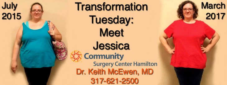 2 life bariatrics 2life bariatrics b j's bariatrics bailey bariatrics baja bariatrics bariatric center bariatric center muncie bariatric chair bariatric chamber bariatric commode bariatric eating bariatric eating cookbook bariatric eating coupon bariatric eating coupon code bariatric embolization bariatric equipment bariatric evaluation bariatric exercises bariatric hoist bariatric hospital bed bariatric hospital bed dimensions bariatric hospital bed sheets bariatric hoyer lift bariatric pantry bariatric quad cane bariatric quad cane hcpcs bariatric quad stick bariatric qualifications bariatric quality of life questionnaire bariatric questionnaire bariatric questions bariatric quiche recipe bariatric quotes bariatric sleeve surgery bariatric surgery bariatric surgery definition bariatric surgery diet bariatric surgery indiana bariatric surgery indianapolis bariatric underwear bariatric y surgery bariatric yoga bariatric yoga poses bariatric yogurt bariatric youth walker bariatric youtube bariatric zero gravity chairs bariatric zero gravity recliner bariatric zimmer bariatric zimmer frame bariatric zinc bariatric zucchini bread bariatric zucchini recipes bariatricpal bariatricpal coupon bariatricpal food bariatricpal mx bariatricpal promo code bariatricpal reviews bariatricpsychevaluations bariatrics bariatrics & metabolism initiative bariatrics 15068 bariatrics 15108 bariatrics 15317 bariatrics 360 bariatrics 4 diabetes bariatrics advantage bariatrics alabama bariatrics albany medical center bariatrics albuquerque bariatrics anderson sc bariatrics app bariatrics association bariatrics atlanta ga bariatrics australia bariatrics australia sydney bariatrics baltimore bariatrics birmingham al bariatrics brisbane bariatrics brookwood bariatrics charlotte nc bariatrics choice bariatrics cleveland clinic bariatrics clinic bariatrics columbia mo bariatrics dallas tx bariatrics definition bariatrics denver bariatrics dfw bariatrics diet bariatrics diet food bariatrics diet plan bariatrics direct bariatrics doctor bariatrics dr morgan bariatrics easley sc bariatrics erie pa bariatrics fellowship bariatrics florida bariatrics food bariatrics for diabetes bariatrics for dummies bariatrics fort mill sc bariatrics fort wayne bariatrics fort worth bariatrics forum bariatrics fresno ca bariatrics gastonia nc bariatrics gbmc bariatrics georgetown ky bariatrics georgia bariatrics georgia columbus ga bariatrics greensburg pa bariatrics greentree bariatrics greentree pa bariatrics greenville sc bariatrics hamilton bariatrics health and wellness bariatrics highland hospital bariatrics in atlanta bariatrics in birmingham al bariatrics in mexico bariatrics in pittsburgh bariatrics in san antonio bariatrics in spanish bariatrics indianapolis bariatrics is a field of medicine that specializes in bariatrics is the study of bariatrics is the treatment of bariatrics jackson ms bariatrics jacksonville fl bariatrics jacobi bariatrics jax bariatrics job description bariatrics johnstown pa bariatrics journal bariatrics kaiser bariatrics kaiser permanente bariatrics kansas city bariatrics lancaster pa bariatrics las vegas bariatrics lawton ok bariatrics lexington ky bariatrics louisville ky bariatrics lower burrell pa bariatrics lubbock tx bariatrics macon ga bariatrics mcmurray bariatrics medicine bariatrics melbourne bariatrics memphis tn bariatrics mexico bariatrics monroeville bariatrics moon township bariatrics nashville tn bariatrics near me bariatrics new haven ct bariatrics news bariatrics nhs bariatrics nj bariatrics north hills pa bariatrics northwest bariatrics nurse bariatrics nutrition bariatrics of alabama cost bariatrics of alabama food bariatrics of alabama reviews bariatrics of kansas city bariatrics of nc bariatrics of texas bariatrics of texas wichita falls bariatrics of tuscaloosa bariatrics of western new york bariatrics ontario bariatrics paducah ky bariatrics pronunciation bariatrics raleigh nc bariatrics recipes bariatrics registry bariatrics reno bariatrics residency bariatrics reviews bariatrics rock hill sc bariatrics sacramento 525 bariatrics san antonio bariatrics sleeve bariatrics st marys bariatrics surgery cost bariatrics tampa bariatrics tijuana bariatrics times bariatrics today bariatrics toronto bariatrics treatment bariatrics tucson az bariatrics tulsa bariatrics tuscaloosa bariatrics tyler tx bariatrics ucla bariatrics ucsd bariatrics uk bariatrics uniontown pa bariatrics unit bariatrics university of missouri bariatrics unlimited bariatrics unmc bariatrics utah bariatrics valdosta ga bariatrics vanderbilt bariatrics vestavia al bariatrics victoria tx bariatrics virginia beach bariatrics vitamins bariatrics vocabulary bariatrics waco tx bariatrics washington pa bariatrics weight loss bariatrics weight loss program bariatrics weight loss tuscaloosa al bariatrics wichita falls tx bariatrics wiki bariatrics winchester va bariatrics works bariatrics works reviews bariatrics ypsilanti bariatrics yuma az barker bariatrics bj bariatrics blossom bariatrics bluegrass bariatrics geriatrics jobs geriatrics md gwinnett bariatrics hollywood bariatrics hope bariatrics jefferson bariatrics jersey bariatrics kaiser bariatrics sacramento kennedy bariatrics kennedy bariatrics nj kentucky bariatrics winchester kettering bariatrics kettering bariatrics dr schumacher kim bariatrics l.a. bariatrics lifeweigh bariatrics lovelace bariatrics lovelace bariatrics albuquerque phone number queensland bariatrics riverside bariatrics columbus ohio rockland bariatrics rockwood bariatrics spokane wa suitable for a bariatrics study suitable for a bariatrics study crossword suitable for a bariatrics study crossword clue tidewater+bariatrics+1413+kempsville+road+chesapeake+va u health bariatrics u of m bariatrics u penn bariatrics u.s. bariatrics u.s. bariatrics st augustine ventura bariatrics virginia bariatrics virtua bariatrics what is a bariatrics doctor yale bariatrics
