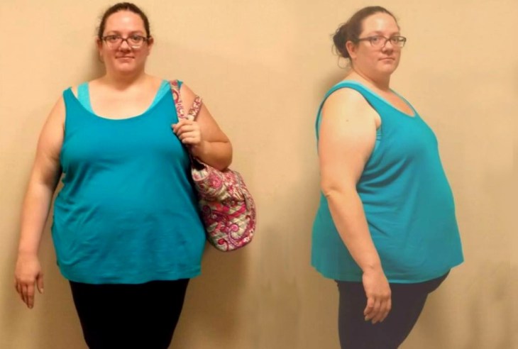 Dr. Keith McEwen MD Indianapolis Indiana Carmel Nobelsville Anderson Hamilton Community Surgery Center Hamilton Community Bariatrics Hamilton 46060 46011 46062 46033 46037 46074 46032 46220 46226 46055 46064 46030 46203 46239 46259 46163 46142 46143 lap-band system lap band system cost lap band system reviews lap band system patient education