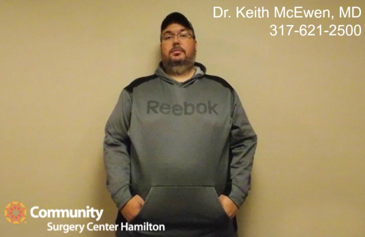 Dr. Keith McEwen MD Indianapolis Indiana Carmel Nobelsville Anderson Hamilton Community Surgery Center Hamilton Community Bariatrics Hamilton 46060 46011 46062 46033 46037 46074 46032 46220 46226 46055 46064 46030 46203 46239 46259 46163 46142 46143 lap-band system lap band system cost lap band system reviews lap band system patient education seminars lap band system access port lap band system pedometer lap band public system lap band ap system mri safety bioenterics lap band system lap-band ap system small lap band system lap-band system allergan lap band ap system large lap band gastric banding system franciscan health system lap band the new lap band system lap band through public system lap band surgery public system lap band system surgery the lap band system lap-band vg system what is lap band systemlap-band procedure lap-band removal lap-band system lap-band cost lap-band weight loss surgery lap-band complications lap-band diet lap-band® lap-band reviews lap-band alternative lap-band lap-band surgery lap-band adjustable gastric banding system lap band and pregnancy lap band australia lap band after gastric bypass lap band az lap band adjustment lap band and alcohol lap band and acid reflux lap band austin a lap band surgery a lap band removing a lap band can lapband be removed is a lap band permanent is a lap band safe is a lap band covered by insurance is a lap band reversible how a lap band works does a lap band work lap band before and after lap band before and after pictures lap band blog lap band before and after pics lap band brisbane lap band bmi lap band birmingham al lap band blockage lap band before and after stories lap band bariatric surgery b-2240 lap band lap band cost without insurance lap band covered by insurance lap band criteria lap band complications years later lap band canada lap band chicago lap band calgary lap band cons realize c lap band clap clap band clap clap bandcamp c section with lap band c-section and lap band surgery c section after lap band hepatitis c and lap band surgery lap band diet menu lap band diet plan lap band dallas lap band diet recipes lap band doctors lap band diet after surgery lap band dance lap band deaths lap band diet without surgery vitamin d deficiency lap band lap band erosion lap band edmonton lap band eligibility lap band erosion causes lap band eating plan lap band erosion lawsuit lap band experiences lap band eating rules lap band esophagus problems lap band erosion complications o que e lap band lap band forum lap band fill lap band failure lap band friendly recipes lap band forum australia lap band failure rate lap band food stuck lap band fill centers lap band failure stories lap band fort worth lap band gal lap band gone wrong lap band gas pain lap band gaining weight back lap band guidelines lap band gurgling noises lap band green zone lap band gallbladder issues lap band good or bad lap band gerd issues lap band houston lap band hypnosis lap band horror stories lap band heartburn and reflux lap band heartburn lap band hypnotherapy lap band houston cost lap band hobart lap band hair loss lap band hernia h pylori lap band lap band insurance lap band issues lap band in mexico lap band information lap band images lap band indiana lap band insurance requirements lap band infection lap band in houston lap band in mexico cost i lap band i want lap band surgery lap band jacksonville fl lap band journey lap band journey blog lap band jackson ms lap band joplin mo lap band joondalup lap band journal lap band jonesboro arkansas lap band jokes lap band juicing j&j lap band lap band kansas city lap band kaiser lap band knoxville tn lap band kelowna lap band killeen texas lap band katy tx lap band kidney stones lap band korea lap band kingsport tn lap band katy lap band lawsuit lap band las vegas lap band liquid diet lap band louisville ky lap band little rock ar lap band leak symptoms lap band lubbock lap band liquid diet recipes lap band long term complications lap band los angeles lap band mexico lap band meal plan lap band miami lap band mri safety lap band melbourne lap band meals lap band macon ga lap band medicare lap band memphis lap band mexico cost u of m lap band surgery lap band not working lap band not losing weight lap band night cough lap band nj lap band nz lap band nyc lap band no surgery lap band no weight loss lap band nausea lap band nutrition guidelines lite n easy lap band lap band or sleeve lap band okc lap band of louisville lap band ontario lap band orlando lap band operation lap band oklahoma lap band ontario cost lap band omaha lap band or sleeve which is better o sign lap band o'brien lap band placer cost of lap band surgery symptoms of lap band erosion removal of lap band dangers of lap band surgery symptoms of lap band slippage complications of lap band surgery complications of lap band cost of lap band removal lap band problems lap band pictures lap band pros and cons lap band pre op diet lap band port lap band price lap band port pain lap band post op diet lap band pregnancy s p lap band lap band qualifications lap band qualifications 2014 lap band qualifications 2015 lap band qualifications 2013 lap band questions lap band questions and answers lap band quiz lap band queensland lap band quick weight loss lap band qld q&a lap band lap band requirements lap band recipes lap band recovery lap band risks lap band results lap band removal recovery lap band removal surgery lap band removal complications lap-band surgery pros and cons lap band surgery cost lap band side effects lap band slippage lap band surgery reviews lap band surgery requirements lap band success stories lap band surgery risks s code for lap band adjustment what is lap band lap band talk lap band toronto lap band to sleeve revision lap band to gastric sleeve lap band testimonials lap band to gastric sleeve revision lap band tulsa lap band tucson lap band to gastric sleeve conversion lap band to sleeve conversion lap band t shirt lap band utah lap band uk lap band utah cost lap band unfill lap band united healthcare lap band ulcer lap band unfilled problems lap band ulcer issues lap band unsuccessful stories lap band upper gi youtube lap band youtube lap band surgery lap band u of m lap band vs sleeve lap band vomiting lap band video lap band vs bypass lap band vomiting after eating lap band vs sleeve 2013 lap band vomiting slime lap band vancouver lap band vs slimband lap band vomiting in sleep gastric bypass v lap band lap band v sleeve lap band weight loss lap band with plication lap band wiki lap band weight loss expectations lap band without surgery lap band weight loss results lap band weight requirements lap band weight loss first month lap band weight loss rate lap band w/plication lap band x ray gastric band x ray lap band slippage x ray slipped lap band x ray lap band position x ray gastric lap band x ray lap band angle x ray lap band surgery x ray x ray of lap band x ray of slipped lap band gas x after lap band lap band youtube lap band youtube video lap band youtube before and after lap band yahoo answers lap band yes or no lap band young adults lap band yuma az lap band years later lap band york pa lap band youtube 2012 lap band zones lap band zephyrhills florida gastric band zones lap band red zone lap band surgery zanesville ohio lap band new zealand lap band cost new zealand zoloft lap band lap band surgery christchurch new zealand gastric band zürich lap band 10 years later lap band 1st fill lap band 1 year later lap band 1 week post op lap band 101 lap band 1 month post-op lap band 18 years old lap band 16 year old lap band 14cc lap band 15 year old 1 800 lap band week 1 lap band diet lap band 2014 lap band 2013 lap band 2 week liquid diet lap band 2015 lap band 20 years old lap band 2 years post-op lap band 2 weeks post op lap band 2 months post op lap band 22 years old lap band 200 lbs week 2 lap band diet 2 year old lap band 2 dangers of lap band surgery 2 years after lap band 2 months after lap band 2 weeks after lap band lap band 2 years later day 2 after lap band lap band 30 pounds overweight lap band 3 weeks post op lap band 3 months post op lap band 3 years post op lap band 3 days post op lap band 35 bmi lap band 3 months later lap band 3 years later lap band 33 bmi lap band 31 bmi stage 3 lap band diet 3 lap joint band clamp week 3 lap band diet phase 3 lap band diet 3 months after lap band 3 days post lap band week 3 post lap band lap band 4 years later lap band 40 pounds overweight lap band 400 lbs lap band 4cc lap band after 4 years lap band for 40 lbs. overweight lap band week 4 allergan lap band 4cc lap band stage 4 diet lap band to lose 40 pounds stage 4 lap band diet 4 years after lap band 4 weeks after lap band lap band 5 years later lap band 5 day pouch test lap band 5 years post op lap band 50 lbs overweight lap band 5 cc fill lap band 5 months post op lap band 5 weeks post-op lap band $5000 lap band 50 pounds overweight lap band 5 day diet stage 5 lap band diet 5 years after lap band 5 days post op lap-band lap band 6 months post op lap band 60 pounds overweight lap band 6 years later lap band 6 cc fill lap band 6 weeks post op lap band 6 month diet lap band after 6 years lap band after 6 months lap band surgery over 60 lap band surgery over 65 6 months after lap band lap band 70 pounds overweight lap band after 7 years lap band surgery 77062 lap band 8 golden rules lap band after 8 years 800 lap band 8 golden rules lap band 8 rules of lap band lap band icd 9 lap band icd-9 code lap band erosion icd 9 lap band removal icd 9 lap band complication icd 9 lap band failure icd 9 slipped lap band icd-9 code 9.75 lap band infected lap band icd 9 icd 9 lap band complications icd 9 lap band icd 9 lap band surgery icd 9 lap band adjustment icd 9 gastric lap band icd 9 failed lap band icd 9 for lap band erosion bariatric banding surgery bariatric band surgery cost bariatric band diet bariatric band slippage bariatric band fills bariatric band complications bariatric band adjustment bariatric band manufacturers bariatric lap band bariatric lap band surgery problems bariatric band bariatric band surgery lap band bariatric surgery stomach band after pregnancy stomach band after c section stomach band as seen on tv stomach band after hysterectomy stomach band and cream to lose weight stomach band alternative stomach band at walmart stomach band and pregnancy stomach band after cesarean bariatric belly band stomach burner band stomach band before and after stomach band belt baby stomach band best stomach band after pregnancy best stomach band ballet stomach band lap band bariatric surgery before after bariatric surgery bypass vs band stomach band cost laparoscopic band complications stomach band covered by insurance stomach band cost canada stomach band canada stomach band cost sydney stomach band cost uk laparoscopic band cost stomach band candidate stomach band during pregnancy stomach band diabetes bariatric lap band diet bariatric surgery lap band diet stomach band exercise stomach band erosion stomach elastic band stomach earth band stomach elastic band surgery' stomach band to lose weight stomach band for working out stomach band for after pregnancy stomach band for pregnancy stomach band for exercise stomach band for acid reflux stomach band for running stomach band for abs stomach band for working out walmart stomach band hypnosis stomach band holster stomach band hypnotherapy stomach heat band stomach band infomercial stomach band in pakistan i-band bariatric surgery stomach band japanese stomach band japan stomach band lose weight stomach lift band lap band bariatric surgery cost lap band bariatric surgery forums lap band vs bariatric surgery bariatric lap band surgery diet bariatric lap band recipes stomach band mexico stomach band modells stomach muscle band stomach monkeys band stomach mouth band stomach band nz stomach band operation stomach band on nhs lap band or bariatric surgery stomach omaha band stomach band procedure stomach band post pregnancy stomach band pregnancy stomach band price stomach band problems laparoscopic band phi angle laparoscopic band placement laparoscopic band port stomach band perth laparoscopic band passer laparoscopic band removal stomach band reviews laparoscopic band radiographics stomach band removal laparoscopic band removal cpt code stomach band requirements stomach band risks stomach band recovery time laparoscopic band radiology laparoscopic band removal cpt bariatric surgery band slip stomach band surgery cost laparoscopic band surgery stomach band surgery risks stomach band surgery cost canada stomach band side effects laparoscopic band surgery cost stomach band to lose belly fat stomach band to lose weight cost stomach band that burns fat stomach band that makes you sweat stomach band to sweat stomach band to lose weight as seen on tv stomach band to workout stomach band toronto stomach band target stomach band uk stomach vibrating band lap band vs sleeve bariatric surgery bariatric sleeve vs band bariatric advantage vitaband stomach band walmart stomach band workout stomach band while working out stomach band wrap stomach band with gel stomach band while exercising stomach band wiki stomach band working out stomach band with lotion stomach band youtube lapbandindiana.com