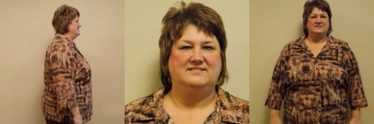 Dr. Keith McEwen MD Indianapolis Indiana Carmel Nobelsville Anderson Hamilton Community Surgery Center Hamilton Community Bariatrics Hamilton 46060 46011 46062 46033 46037 46074 46032 46220 46226 46055 46064 46030 46203 46239 46259 46163 46142 46143 lap-band system lap band system cost lap band system reviews lap band system patient education seminars lap band system access port lap band system pedometer lap band public system lap band ap system mri safety bioenterics lap band system lap-band ap system small lap band system lap-band system allergan lap band ap system large lap band gastric banding system franciscan health system lap band the new lap band system lap band through public system lap band surgery public system lap band system surgery the lap band system lap-band vg system what is lap band systemlap-band procedure lap-band removal lap-band system lap-band cost lap-band weight loss surgery lap-band complications lap-band diet lap-band® lap-band reviews lap-band alternative lap-band lap-band surgery lap-band adjustable gastric banding system lap band and pregnancy lap band australia lap band after gastric bypass lap band az lap band adjustment lap band and alcohol lap band and acid reflux lap band austin a lap band surgery a lap band removing a lap band can lapband be removed is a lap band permanent is a lap band safe is a lap band covered by insurance is a lap band reversible how a lap band works does a lap band work lap band before and after lap band before and after pictures lap band blog lap band before and after pics lap band brisbane lap band bmi lap band birmingham al lap band blockage lap band before and after stories lap band bariatric surgery b-2240 lap band lap band cost without insurance lap band covered by insurance lap band criteria lap band complications years later lap band canada lap band chicago lap band calgary lap band cons realize c lap band clap clap band clap clap bandcamp c section with lap band c-section and lap band surgery c section after lap band hepatitis c and lap band surgery lap band diet menu lap band diet plan lap band dallas lap band diet recipes lap band doctors lap band diet after surgery lap band dance lap band deaths lap band diet without surgery vitamin d deficiency lap band lap band erosion lap band edmonton lap band eligibility lap band erosion causes lap band eating plan lap band erosion lawsuit lap band experiences lap band eating rules lap band esophagus problems lap band erosion complications o que e lap band lap band forum lap band fill lap band failure lap band friendly recipes lap band forum australia lap band failure rate lap band food stuck lap band fill centers lap band failure stories lap band fort worth lap band gal lap band gone wrong lap band gas pain lap band gaining weight back lap band guidelines lap band gurgling noises lap band green zone lap band gallbladder issues lap band good or bad lap band gerd issues lap band houston lap band hypnosis lap band horror stories lap band heartburn and reflux lap band heartburn lap band hypnotherapy lap band houston cost lap band hobart lap band hair loss lap band hernia h pylori lap band lap band insurance lap band issues lap band in mexico lap band information lap band images lap band indiana lap band insurance requirements lap band infection lap band in houston lap band in mexico cost i lap band i want lap band surgery lap band jacksonville fl lap band journey lap band journey blog lap band jackson ms lap band joplin mo lap band joondalup lap band journal lap band jonesboro arkansas lap band jokes lap band juicing j&j lap band lap band kansas city lap band kaiser lap band knoxville tn lap band kelowna lap band killeen texas lap band katy tx lap band kidney stones lap band korea lap band kingsport tn lap band katy lap band lawsuit lap band las vegas lap band liquid diet lap band louisville ky lap band little rock ar lap band leak symptoms lap band lubbock lap band liquid diet recipes lap band long term complications lap band los angeles lap band mexico lap band meal plan lap band miami lap band mri safety lap band melbourne lap band meals lap band macon ga lap band medicare lap band memphis lap band mexico cost u of m lap band surgery lap band not working lap band not losing weight lap band night cough lap band nj lap band nz lap band nyc lap band no surgery lap band no weight loss lap band nausea lap band nutrition guidelines lite n easy lap band lap band or sleeve lap band okc lap band of louisville lap band ontario lap band orlando lap band operation lap band oklahoma lap band ontario cost lap band omaha lap band or sleeve which is better o sign lap band o'brien lap band placer cost of lap band surgery symptoms of lap band erosion removal of lap band dangers of lap band surgery symptoms of lap band slippage complications of lap band surgery complications of lap band cost of lap band removal lap band problems lap band pictures lap band pros and cons lap band pre op diet lap band port lap band price lap band port pain lap band post op diet lap band pregnancy s p lap band lap band qualifications lap band qualifications 2014 lap band qualifications 2015 lap band qualifications 2013 lap band questions lap band questions and answers lap band quiz lap band queensland lap band quick weight loss lap band qld q&a lap band lap band requirements lap band recipes lap band recovery lap band risks lap band results lap band removal recovery lap band removal surgery lap band removal complications lap-band surgery pros and cons lap band surgery cost lap band side effects lap band slippage lap band surgery reviews lap band surgery requirements lap band success stories lap band surgery risks s code for lap band adjustment what is lap band lap band talk lap band toronto lap band to sleeve revision lap band to gastric sleeve lap band testimonials lap band to gastric sleeve revision lap band tulsa lap band tucson lap band to gastric sleeve conversion lap band to sleeve conversion lap band t shirt lap band utah lap band uk lap band utah cost lap band unfill lap band united healthcare lap band ulcer lap band unfilled problems lap band ulcer issues lap band unsuccessful stories lap band upper gi youtube lap band youtube lap band surgery lap band u of m lap band vs sleeve lap band vomiting lap band video lap band vs bypass lap band vomiting after eating lap band vs sleeve 2013 lap band vomiting slime lap band vancouver lap band vs slimband lap band vomiting in sleep gastric bypass v lap band lap band v sleeve lap band weight loss lap band with plication lap band wiki lap band weight loss expectations lap band without surgery lap band weight loss results lap band weight requirements lap band weight loss first month lap band weight loss rate lap band w/plication lap band x ray gastric band x ray lap band slippage x ray slipped lap band x ray lap band position x ray gastric lap band x ray lap band angle x ray lap band surgery x ray x ray of lap band x ray of slipped lap band gas x after lap band lap band youtube lap band youtube video lap band youtube before and after lap band yahoo answers lap band yes or no lap band young adults lap band yuma az lap band years later lap band york pa lap band youtube 2012 lap band zones lap band zephyrhills florida gastric band zones lap band red zone lap band surgery zanesville ohio lap band new zealand lap band cost new zealand zoloft lap band lap band surgery christchurch new zealand gastric band zürich lap band 10 years later lap band 1st fill lap band 1 year later lap band 1 week post op lap band 101 lap band 1 month post-op lap band 18 years old lap band 16 year old lap band 14cc lap band 15 year old 1 800 lap band week 1 lap band diet lap band 2014 lap band 2013 lap band 2 week liquid diet lap band 2015 lap band 20 years old lap band 2 years post-op lap band 2 weeks post op lap band 2 months post op lap band 22 years old lap band 200 lbs week 2 lap band diet 2 year old lap band 2 dangers of lap band surgery 2 years after lap band 2 months after lap band 2 weeks after lap band lap band 2 years later day 2 after lap band lap band 30 pounds overweight lap band 3 weeks post op lap band 3 months post op lap band 3 years post op lap band 3 days post op lap band 35 bmi lap band 3 months later lap band 3 years later lap band 33 bmi lap band 31 bmi stage 3 lap band diet 3 lap joint band clamp week 3 lap band diet phase 3 lap band diet 3 months after lap band 3 days post lap band week 3 post lap band lap band 4 years later lap band 40 pounds overweight lap band 400 lbs lap band 4cc lap band after 4 years lap band for 40 lbs. overweight lap band week 4 allergan lap band 4cc lap band stage 4 diet lap band to lose 40 pounds stage 4 lap band diet 4 years after lap band 4 weeks after lap band lap band 5 years later lap band 5 day pouch test lap band 5 years post op lap band 50 lbs overweight lap band 5 cc fill lap band 5 months post op lap band 5 weeks post-op lap band $5000 lap band 50 pounds overweight lap band 5 day diet stage 5 lap band diet 5 years after lap band 5 days post op lap-band lap band 6 months post op lap band 60 pounds overweight lap band 6 years later lap band 6 cc fill lap band 6 weeks post op lap band 6 month diet lap band after 6 years lap band after 6 months lap band surgery over 60 lap band surgery over 65 6 months after lap band lap band 70 pounds overweight lap band after 7 years lap band surgery 77062 lap band 8 golden rules lap band after 8 years 800 lap band 8 golden rules lap band 8 rules of lap band lap band icd 9 lap band icd-9 code lap band erosion icd 9 lap band removal icd 9 lap band complication icd 9 lap band failure icd 9 slipped lap band icd-9 code 9.75 lap band infected lap band icd 9 icd 9 lap band complications icd 9 lap band icd 9 lap band surgery icd 9 lap band adjustment icd 9 gastric lap band icd 9 failed lap band icd 9 for lap band erosion bariatric banding surgery bariatric band surgery cost bariatric band diet bariatric band slippage bariatric band fills bariatric band complications bariatric band adjustment bariatric band manufacturers bariatric lap band bariatric lap band surgery problems bariatric band bariatric band surgery lap band bariatric surgery stomach band after pregnancy stomach band after c section stomach band as seen on tv stomach band after hysterectomy stomach band and cream to lose weight stomach band alternative stomach band at walmart stomach band and pregnancy stomach band after cesarean bariatric belly band stomach burner band stomach band before and after stomach band belt baby stomach band best stomach band after pregnancy best stomach band ballet stomach band lap band bariatric surgery before after bariatric surgery bypass vs band stomach band cost laparoscopic band complications stomach band covered by insurance stomach band cost canada stomach band canada stomach band cost sydney stomach band cost uk laparoscopic band cost stomach band candidate stomach band during pregnancy stomach band diabetes bariatric lap band diet bariatric surgery lap band diet stomach band exercise stomach band erosion stomach elastic band stomach earth band stomach elastic band surgery' stomach band to lose weight stomach band for working out stomach band for after pregnancy stomach band for pregnancy stomach band for exercise stomach band for acid reflux stomach band for running stomach band for abs stomach band for working out walmart stomach band hypnosis stomach band holster stomach band hypnotherapy stomach heat band stomach band infomercial stomach band in pakistan i-band bariatric surgery stomach band japanese stomach band japan stomach band lose weight stomach lift band lap band bariatric surgery cost lap band bariatric surgery forums lap band vs bariatric surgery bariatric lap band surgery diet bariatric lap band recipes stomach band mexico stomach band modells stomach muscle band stomach monkeys band stomach mouth band stomach band nz stomach band operation stomach band on nhs lap band or bariatric surgery stomach omaha band stomach band procedure stomach band post pregnancy stomach band pregnancy stomach band price stomach band problems laparoscopic band phi angle laparoscopic band placement laparoscopic band port stomach band perth laparoscopic band passer laparoscopic band removal stomach band reviews laparoscopic band radiographics stomach band removal laparoscopic band removal cpt code stomach band requirements stomach band risks stomach band recovery time laparoscopic band radiology laparoscopic band removal cpt bariatric surgery band slip stomach band surgery cost laparoscopic band surgery stomach band surgery risks stomach band surgery cost canada stomach band side effects laparoscopic band surgery cost stomach band to lose belly fat stomach band to lose weight cost stomach band that burns fat stomach band that makes you sweat stomach band to sweat stomach band to lose weight as seen on tv stomach band to workout stomach band toronto stomach band target stomach band uk stomach vibrating band lap band vs sleeve bariatric surgery bariatric sleeve vs band bariatric advantage vitaband stomach band walmart stomach band workout stomach band while working out stomach band wrap stomach band with gel stomach band while exercising stomach band wiki stomach band working out stomach band with lotion stomach band youtube lapbandindiana.com