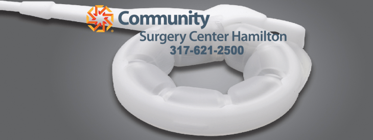 acid reflux after lap band adjustment adjustment of lap band adjustment of lap band cpt billing for lap band adjustment cost of lap band adjustment cpt for lap band adjustment diagnosis code for lap band adjustment does lap band adjustment hurt eating after a lap band adjustment eating after lap band adjustment emergency lap band adjustment frequency of lap band adjustment gastric band adjustment aberdeen gastric band adjustment at home gastric band adjustment birmingham gastric band adjustment brighton gastric band adjustment clinic liverpool gastric band adjustment clinics london gastric band adjustment credentialing guidelines for physician extenders gastric band adjustment diet gastric band adjustment dubai gastric band adjustment edinburgh gastric band adjustment essex gastric band adjustment glasgow gastric band adjustment harrow gastric band adjustment ireland gastric band adjustment kent gastric band adjustment leeds gastric band adjustment liverpool gastric band adjustment london gastric band adjustment manchester gastric band adjustment newcastle gastric band adjustment norwich gastric band adjustment nottingham gastric band adjustment prices gastric band adjustment procedure gastric band adjustment protocol gastric band adjustment training gastric band adjustment uk gastric band adjustment video gastric band adjustment yorkshire gastric band adjustments in u.k gastric band port adjustment how are lap band adjustments done icd 9 lap band adjustment icd-9 code for lap band adjustment lap band adjustment lap band adjustment after pregnancy lap band adjustment billing lap band adjustment cairns lap band adjustment centers lap band adjustment chest pain lap band adjustment code lap band adjustment complications lap band adjustment cost lap band adjustment cost uk lap band adjustment cpt code lap band adjustment cpt code 2013 lap band adjustment cpt code medicare lap band adjustment dictation lap band adjustment diet lap band adjustment doctors lap band adjustment during pregnancy lap band adjustment fluoroscopy lap band adjustment frequency lap band adjustment gold coast lap band adjustment houston lap band adjustment how often lap band adjustment icd 9 code lap band adjustment instructions lap band adjustment liquid diet lap band adjustment london lap band adjustment mackay lap band adjustment medicare lap band adjustment melbourne lap band adjustment near me lap band adjustment needle lap band adjustment nj lap band adjustment orlando lap band adjustment pain lap band adjustment perth lap band adjustment phoenix lap band adjustment procedure lap band adjustment procedure code lap band adjustment reimbursement lap band adjustment side effects lap band adjustment training lap band adjustment under fluoroscopy lap band adjustment under fluoroscopy cpt code lap band adjustment video lap band adjustment vomiting lap band adjustment while pregnant lap band adjustments lap band adjustments brisbane lap band adjustments cairns lap band adjustments gold coast lap band adjustments houston tx lap band adjustments how often lap band adjustments in miami lap band adjustments las vegas lap band adjustments melbourne lap band adjustments near me lap band diet after adjustment lap band fill adjustment lap band first adjustment lap band post adjustment diet liquid diet after lap band adjustment needle used for lap band adjustment pain after lap band adjustment s code for lap band adjustment still hungry after lap band adjustment vomiting after lap band adjustment weight gain after lap band adjustment what is a lap band adjustment what is lap band adjustment