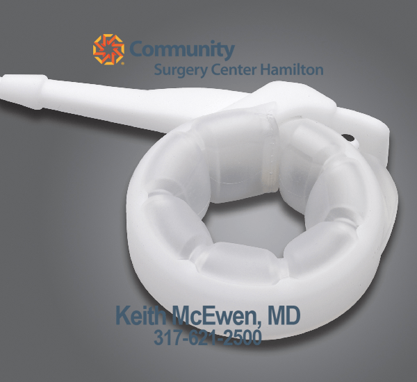 What Are LAP-BAND Adjustments & Why Do We Perform&nbsp;Them?