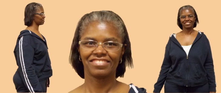 Michelle TT 3 Transformation Tuesday Weight Loss Surgery Dr. Keith McEwen Lab-Band Hamilton Indianapolis Indiana obesity center 317-621-2500 labpandindiana