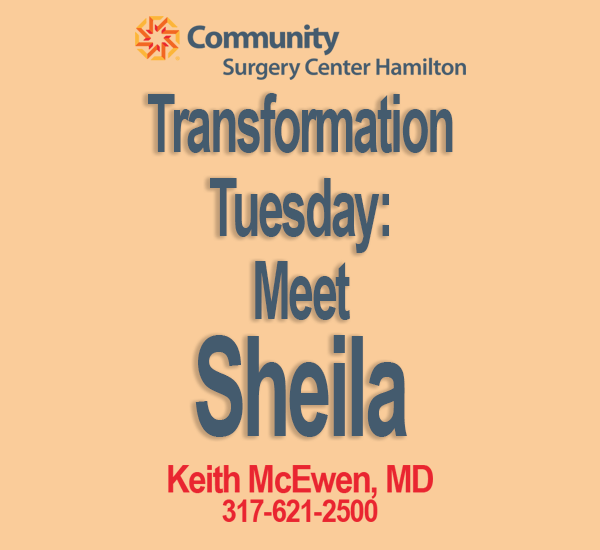 Transformation Tuesday: Sheila