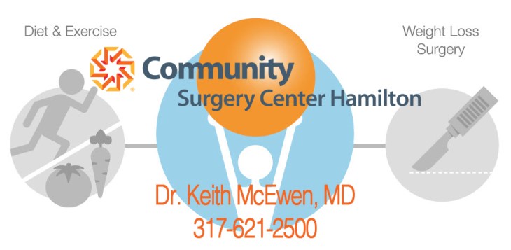 orbera balloon orbera balloon arkansas orbera balloon atlanta orbera balloon australia orbera balloon before and after orbera balloon bmi orbera balloon brisbane orbera balloon chicago orbera balloon complications orbera balloon cost orbera balloon cost australia orbera balloon cost uk orbera balloon covered by insurance orbera balloon cpt orbera balloon cpt code orbera balloon diet orbera balloon forum orbera balloon houston orbera balloon insertion orbera balloon insurance orbera balloon material orbera balloon melbourne orbera balloon melbourne cost orbera balloon mexico orbera balloon near me orbera balloon oklahoma orbera balloon placement cpt code orbera balloon price orbera balloon procedure orbera balloon recovery orbera balloon removal orbera balloon results orbera balloon review orbera balloon reviews australia orbera balloon risks orbera balloon side effects orbera balloon success orbera balloon success stories orbera balloon surgery orbera balloon sydney orbera balloon system orbera balloon uk orbera balloon video orbera balloon weight loss orbera balloon wiki orbera balloon youtube orbera gastric balloon orbera gastric balloon brisbane orbera gastric balloon canada orbera gastric balloon cost orbera gastric balloon cost uk orbera gastric balloon melbourne orbera gastric balloon nhs orbera gastric balloon perth orbera gastric balloon price orbera gastric balloon reviews orbera gastric balloon side effects orbera gastric balloon uk orbera intragastric balloon orbera intragastric balloon cost orbera intragastric balloon forum orbera intragastric balloon reviews orbera intragastric balloon side effects orbera intragastric balloon system orbera weight loss balloon orbera weight loss balloon cost orbera weight loss balloon reviews