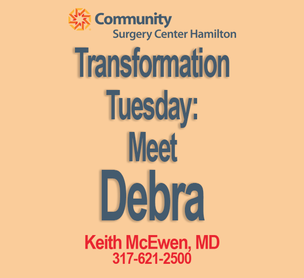Transformation Tuesday: Debra
