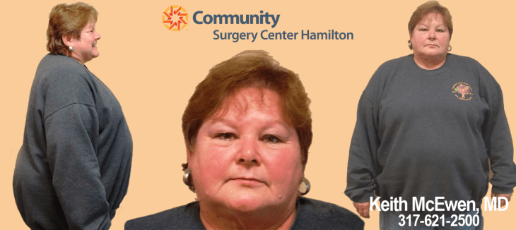 1 month weight loss transformation 1 week weight loss transformation 10 pound weight loss transformation 10 week weight loss transformation 100 lb weight loss transformation 100lbs weight loss transformation 14 year old weight loss transformation 150 pound weight loss transformation 16 week weight loss transformation 2 month weight loss transformation 2 month weight loss transformation tumblr 2 stone weight loss transformation 2 week weight loss transformation 2 year weight loss transformation 20 pound weight loss transformation 28 day weight loss transformation 3 month body transformation weight loss 3 month weight loss transformation 3 month weight loss transformation tumblr 3 week weight loss transformation 30 pound weight loss transformation 30lb weight loss transformation 4 month weight loss transformation 4 week weight loss transformation 40 day weight loss transformation 40 kg weight loss transformation 40 pound weight loss transformation 5 month weight loss transformation 5 second weight loss transformation 5 week weight loss transformation 50 lbs weight loss transformation 6 month body transformation weight loss 6 month weight loss transformation 6 week weight loss transformation 60 pound weight loss transformation 7 month weight loss transformation 7 week weight loss transformation 70 pound weight loss transformation 8 amazing blogger weight-loss transformations 8 month weight loss transformation 8 week weight loss transformation 80 pound weight loss transformation 9 month weight loss transformation 9 week weight loss transformation amazing weight loss transformations youtube best weight loss transformations on instagram biggest weight loss transformation ever bruce extreme weight loss transformation cellucor weight loss system extreme transformation kit dramatic weight loss transformation endomorph weight loss transformation epic weight loss transformation epic weight loss transformation win extreme weight loss transformation extreme weight loss transformation boot camp female weight loss transformation pictures gma weight loss transformation gym weight loss transformation hcg weight loss transformation herbalife weight loss transformation huge weight loss transformation incredible weight loss transformation hottie pics jump rope weight loss transformation ketosis weight loss transformation kickboxing weight loss transformation korean weight loss transformation kpop weight loss transformation mama june weight loss transformation maximum weight loss transformation kit maximum weight loss transformation kit reviews most stunning weight loss transformations ever my 1 year weight loss transformation to shredville my 2 week weight loss body transformation my 84 day weight loss transformation my weight loss transformation from 250 to 190 my weight loss transformation reddit my weight loss transformation youtube obese weight loss transformation photos of weight loss transformation pictures of weight loss transformation quickest weight loss transformation real weight loss transformation shocking weight loss transformation pictures the most amazing weight loss transformation of an indian girl transformation weight loss & vitality centers transformation weight loss and vitality transformation weight loss clinic transformation weight loss huntington wv transformation weight loss kissimmee transformation weight loss lake mary transformation weight loss las vegas transformation weight loss lee road transformation weight loss orlando transformation weight loss recipes transformation weight loss reno transformation weight loss reno nv transformation weight loss reviews vegan weight loss transformation vi maximum weight loss transformation kit virtual weight loss transformation visalus maximum weight loss transformation kit weight loss body transformation weight loss body transformation before and after pics weight loss fitness transformation weight loss leg transformation weight loss muscle gain transformation weight loss surgery stages of transformation weight loss transformation weight loss transformation 1 month weight loss transformation 100 days weight loss transformation 12 weeks weight loss transformation 2 months weight loss transformation 2013 weight loss transformation 2014 weight loss transformation 2015 weight loss transformation 2017 weight loss transformation 3 months weight loss transformation 3 weeks weight loss transformation 4 months weight loss transformation 4 weeks weight loss transformation 5 months weight loss transformation 6 months weight loss transformation 6 weeks weight loss transformation 60 days weight loss transformation abc weight loss transformation after 40 weight loss transformation after baby weight loss transformation after pregnancy weight loss transformation animation weight loss transformation app weight loss transformation asian weight loss transformation at home weight loss transformation avatar weight loss transformation beachbody weight loss transformation before and after weight loss transformation before and after pictures weight loss transformation bikini weight loss transformation blog weight loss transformation bodybuilding weight loss transformation bodybuilding.com weight loss transformation captions weight loss transformation cardio weight loss transformation celebrities weight loss transformation center weight loss transformation coach weight loss transformation contest weight loss transformation crossfit weight loss transformation day by day weight loss transformation diet weight loss transformation diet plan weight loss transformation divorce weight loss transformation documentary weight loss transformation exercises weight loss transformation face weight loss transformation facebook weight loss transformation fake weight loss transformation female weight loss transformation female tumblr weight loss transformation forum weight loss transformation from running weight loss transformation generator weight loss transformation gif weight loss transformation girl weight loss transformation guide weight loss transformation guy weight loss transformation hashtags weight loss transformation how to weight loss transformation ig weight loss transformation images weight loss transformation in 2 months weight loss transformation in 3 months weight loss transformation in 4 weeks weight loss transformation in 5 months weight loss transformation in 6 months weight loss transformation in 60 days weight loss transformation in 90 days weight loss transformation india weight loss transformation indian girl weight loss transformation journey weight loss transformation kit weight loss transformation loose skin weight loss transformation male weight loss transformation male tumblr weight loss transformation meal plan weight loss transformation men's health weight loss transformation month weight loss transformation motivation weight loss transformation movies weight loss transformation muscle weight loss transformation near me weight loss transformation one month weight loss transformation over 40 weight loss transformation over summer weight loss transformation pics weight loss transformation pictures weight loss transformation pictures tumblr weight loss transformation pinterest weight loss transformation plan weight loss transformation program weight loss transformation quora weight loss transformation quotes weight loss transformation reddit weight loss transformation results weight loss transformation routine weight loss transformation running weight loss transformation secrets weight loss transformation shows weight loss transformation simulator weight loss transformation software weight loss transformation songs weight loss transformation stories weight loss transformation stories female weight loss transformation stories india weight loss transformation stories male weight loss transformation stories youtube weight loss transformation tattoo weight loss transformation teenager weight loss transformation through running weight loss transformation time lapse weight loss transformation timeline weight loss transformation tips weight loss transformation tuesday weight loss transformation tumblr weight loss transformation tv shows weight loss transformation videos weight loss transformation week by week weight loss transformation with pcos weight loss transformation with yoga weight loss transformation without surgery weight loss transformation workout plan weight loss transformation workouts weight loss transformation yoga weight loss transformation youtube weight loss transformation.com weight loss transformations weight loss transformations 1 year weight loss transformations 30 days weight loss transformations and how they did it weight loss transformations from walking weight loss transformations how long weight loss transformations in 2 weeks weight loss transformations male stories weight loss transformations over 50 weight loss transformations p90x weight loss transformations pictures before and after weight loss transformations time weight loss transformations uk weight loss weekly transformation weight-loss transformation goes viral year weight loss transformation yoga for weight loss transformation yoga transformation weight loss and balance youtube weight loss transformation