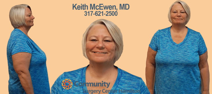 Paula TT 3 Transformation Tuesday Weight Loss Surgery Dr. Keith McEwen Lab-Band Hamilton Indianapolis Indiana obesity center 317-621-2500 labpandindiana