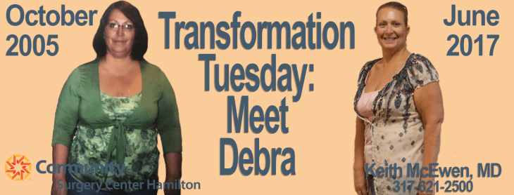 9 round transformation tuesday 9 rounds transformation tuesday 92y transformation tuesday best friend transformation tuesday quotes difference between transformation tuesday and throwback thursday drag transformation tuesday good transformation tuesday captions good transformation tuesday quotes good transformation tuesday songs how to make a transformation tuesday picture on instagram how to make transformation tuesday on instagram huge transformation tuesday k lite transformation tuesday make a transformation tuesday man crush monday transformation tuesday etc quest transformation tuesday transformation tuesday transformation tuesday 21 day fix transformation tuesday 9 round transformation tuesday abbreviation transformation tuesday acronym transformation tuesday and other days transformation tuesday and throwback thursday transformation tuesday anorexia transformation tuesday app transformation tuesday be like transformation tuesday beachbody transformation tuesday because who needs a friend transformation tuesday before and after transformation tuesday best friend transformation tuesday blog transformation tuesday blogilates transformation tuesday bob and larry transformation tuesday body transformation tuesday bodybuilding transformation tuesday breakup transformation tuesday breakup instagram transformation tuesday captions transformation tuesday celebrity transformation tuesday chicken transformation tuesday chicken nugget transformation tuesday chihuahua transformation tuesday cleanse transformation tuesday cnn transformation tuesday collage transformation tuesday couple transformation tuesday creator transformation tuesday day transformation tuesday definition transformation tuesday diet transformation tuesday editor transformation tuesday español transformation tuesday ex boyfriend transformation tuesday examples transformation tuesday facebook transformation tuesday fail transformation tuesday family transformation tuesday fat loss transformation tuesday fitness transformation tuesday fitness quotes transformation tuesday flex friday transformation tuesday funny transformation tuesday funny captions transformation tuesday funny quotes transformation tuesday generator transformation tuesday girl transformation tuesday girlfriend transformation tuesday gordon hayward transformation tuesday hashtags transformation tuesday hln transformation tuesday how to transformation tuesday ideas transformation tuesday images transformation tuesday in spanish transformation tuesday inspiration transformation tuesday instagram transformation tuesday instagram app transformation tuesday instagram captions transformation tuesday instagram hashtags transformation tuesday isagenix transformation tuesday james st james transformation tuesday jokes transformation tuesday kayla itsines transformation tuesday maker transformation tuesday makeup transformation tuesday male transformation tuesday meaning transformation tuesday meme transformation tuesday miley cyrus transformation tuesday monday transformation tuesday motivation transformation tuesday motivational quotes transformation tuesday muscle transformation tuesday ne demek transformation tuesday neville longbottom transformation tuesday nugget transformation tuesday o que é transformation tuesday on facebook transformation tuesday on fb transformation tuesday on instagram transformation tuesday or throwback thursday transformation tuesday or thursday transformation tuesday photo maker transformation tuesday photos transformation tuesday pics transformation tuesday picture maker transformation tuesday pictures transformation tuesday post ideas transformation tuesday posts transformation tuesday pre op transformation tuesday program transformation tuesday puberty transformation tuesday quotes transformation tuesday quotes tumblr transformation tuesday reddit transformation tuesday relationship transformation tuesday rodan and fields transformation tuesday rules transformation tuesday saturday transformation tuesday sayings transformation tuesday selfie sunday transformation tuesday shirt transformation tuesday single transformation tuesday slimming world transformation tuesday snack therapy transformation tuesday songs transformation tuesday status transformation tuesday stories transformation tuesday t25 transformation tuesday tags transformation tuesday template transformation tuesday throwback thursday transformation tuesday throwback thursday monday transformation tuesday throwback thursday selfie sunday transformation tuesday transgender transformation tuesday tumblr transformation tuesday twitter transformation tuesday urban dic transformation tuesday urban dictionary transformation tuesday veggie tales transformation tuesday vine transformation tuesday wayback wednesday transformation tuesday wcw tbt transformation tuesday wednesday transformation tuesday weight gain transformation tuesday weight loss transformation tuesday weight loss quotes transformation tuesday what is it transformation tuesday woman crush wednesday transformation tuesday workout vegan transformation tuesday what is a transformation tuesday