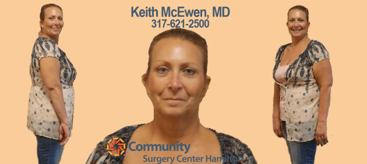 150 pound weight loss transformation (before & after pictures) body transformation after weight loss face transformation after weight loss transformation after lose weight transformation weight loss & nutrition center transformation weight loss & vitality centers transformation weight loss and nutrition center transformation weight loss and skin clinic transformation weight loss before and after transformation weight loss face transformation weight loss florida transformation weight loss groupon transformation weight loss hours transformation weight loss huntington transformation weight loss huntington wv transformation weight loss in kissimmee fl transformation weight loss in reno nv transformation weight loss injections transformation weight loss instagram transformation weight loss kissimmee transformation weight loss lake mary fl transformation weight loss las vegas transformation weight loss lee road transformation weight loss male transformation weight loss meal plan transformation weight loss medication transformation weight loss melbourne transformation weight loss melbourne fl transformation weight loss metrowest transformation weight loss parkersburg wv transformation weight loss pictures transformation weight loss plan transformation weight loss program transformation weight loss quotes transformation weight loss recipes transformation weight loss reno transformation weight loss reno hours transformation weight loss retreat at st. helena’s center for health in napa valley transformation weight loss reviews transformation weight loss shots transformation weight loss south charleston transformation weight loss south charleston wv transformation weight loss stories transformation weight loss surgery transformation weight loss tampa transformation weight loss tumblr transformation weight loss tv show transformation weight loss west virginia transformation weight loss workout transformation weight loss wv transformations weight loss & skin clinic beckley wv transformations weight loss & skin clinic clarksburg wv transformations weight loss and skin clinic clarksburg wv transformations weight loss facebook transformations weight loss flowood ms transformations weight loss hcg transformations weight loss huntington wv reviews transformations weight loss jackson ms transformations weight loss lake mary florida transformations weight loss lake mary reviews transformations weight loss lee rd transformations weight loss melbourne florida transformations weight loss menu transformations weight loss mount dora transformations weight loss pills transformations weight loss price transformations weight loss products transformations weight loss reno nevada transformations weight loss side effects transformations weight loss specials transformations weight loss success stories transformations weight loss winter park transformations weight loss wv reviews weight loss body transformation before and after pics weight loss transformation - before and after pictures great motivation compilation weight loss transformation after baby weight loss transformation after pregnancy weight loss transformation before after weight loss transformation before and after tumblr weight loss transformations after 40