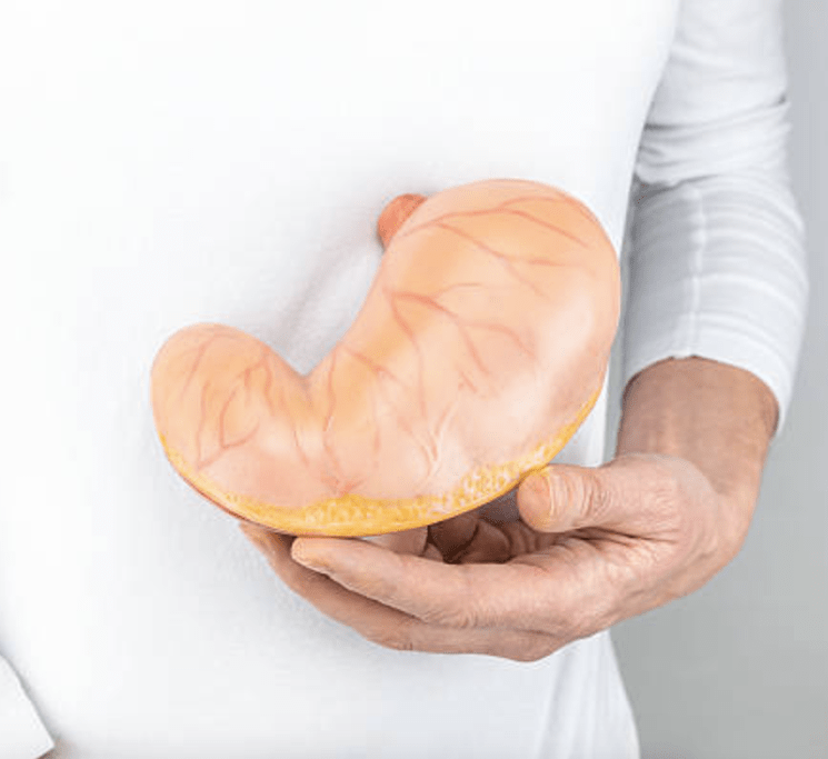 Gastric Band VS. Gastric&nbsp;Sleeve.