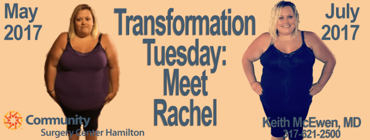 1 week weight loss transformation 1 year weight loss transformation 10 kg weight loss transformation 10 week weight loss transformation 100 day weight loss transformation 100 lb weight loss transformation 120 lb weight loss transformation 14 year old weight loss transformation 140 lb weight loss transformation 150 pound weight loss transformation 16 week weight loss transformation 16 year old weight loss transformation 2 month weight loss transformation 2 month weight loss transformation male 2 stone weight loss transformation 2 week weight loss body transformation 2 week weight loss transformation 2 year weight loss transformation 200 lb weight loss transformation 3 month transformation weight loss male 3 month weight loss transformation 3 month weight loss transformation tumblr 3 stone weight loss transformation 3 week weight loss transformation 30 pound weight loss transformation 30kg weight loss transformation 30lb weight loss transformation 4 month weight loss transformation 4 week weight loss transformation 40 day weight loss transformation 40 kg weight loss transformation 40 pound weight loss transformation 400 lb weight loss transformation 40lb weight loss transformation 5 month weight loss transformation 5 week weight loss transformation 5 week weight loss transformation results 50 lbs weight loss transformation 50 pound weight loss transformation 50lb weight loss transformation 6 month body transformation weight loss 6 month weight loss transformation 6 month weight loss transformation male 6 week weight loss transformation 60 lb weight loss transformation 60 pound weight loss transformation 7 month weight loss transformation 7 week weight loss transformation 70 pound weight loss transformation 8 month weight loss transformation 8 week weight loss transformation 80 pound weight loss transformation 9 month weight loss transformation amazing weight loss transformations youtube best weight loss transformation i've ever seen best weight loss transformations on instagram biggest weight loss transformation ever bob harper beginner's weight loss transformation dvd review celeb weight loss transformations revealed celebrity weight loss transformations revealed cellucor weight loss system extreme transformation kit couple undergo amazing weight loss transformation dramatic weight loss transformation goes viral elliptical weight loss transformation endomorph weight loss transformation epic weight loss transformation extreme transformation weight loss edition extreme weight loss transformation female weight loss transformation pictures gym weight loss transformation hcg weight loss transformation herbalife weight loss transformation hot yoga weight loss transformation huge weight loss transformation images of weight loss transformations jogging weight loss transformation jump rope weight loss transformation ketosis weight loss transformation kickboxing weight loss transformation korean weight loss transformation kpop weight loss transformation male weight loss transformation pictures mama june weight loss transformation my 2 week weight loss body transformation my 84 day weight loss transformation my weight loss transformation from 250 to 190 my weight loss transformation youtube obese weight loss transformation photos of weight loss transformation pictures of weight loss transformations pounds medical weight loss transformation p.c quick weight loss transformation quickest weight loss transformation raw till 4 weight loss transformation shocking weight loss transformation of actors shocking weight loss transformation pictures transformation 360 weight loss transformation tuesday weight loss quotes transformation weight loss & nutrition center transformation weight loss & vitality centers transformation weight loss clinic transformation weight loss clinic reno nv transformation weight loss coupons transformation weight loss drops transformation weight loss hours transformation weight loss huntington wv transformation weight loss kissimmee transformation weight loss lake mary fl transformation weight loss las vegas transformation weight loss lee road transformation weight loss orlando transformation weight loss oviedo transformation weight loss recipes transformation weight loss reno transformation weight loss reno nv transformation weight loss reviews unbelievable weight loss transformation vegan diet weight loss transformation vegan weight loss transformation vegetarian weight loss transformation vi maximum weight loss transformation kit virtual weight loss transformation weight loss amazing transformations weight loss fitness transformation weight loss muscle gain transformation weight loss transformation weight loss transformation 1 month weight loss transformation 12 weeks weight loss transformation 160 lbs weight loss transformation 2 months weight loss transformation 2 weeks weight loss transformation 2014 weight loss transformation 2015 weight loss transformation 2016 weight loss transformation 2017 weight loss transformation 220lbs to 130lbs weight loss transformation 3 months weight loss transformation 3 weeks weight loss transformation 4 months weight loss transformation 4 weeks weight loss transformation 5 months weight loss transformation 6 months weight loss transformation 6 weeks weight loss transformation 60 days weight loss transformation 8 months weight loss transformation 90 days weight loss transformation after 40 weight loss transformation after pregnancy weight loss transformation animation weight loss transformation app weight loss transformation asian weight loss transformation at home weight loss transformation avatar weight loss transformation beachbody weight loss transformation before and after weight loss transformation before and after pictures weight loss transformation before and after tumblr weight loss transformation belfast weight loss transformation biggest loser weight loss transformation bikini weight loss transformation blogs weight loss transformation bodybuilding weight loss transformation book weight loss transformation captions weight loss transformation celebrities weight loss transformation center weight loss transformation challenge weight loss transformation coach weight loss transformation competition weight loss transformation couple weight loss transformation day by day weight loss transformation diary weight loss transformation diet weight loss transformation diet plan weight loss transformation documentary weight loss transformation elizabeth madison weight loss transformation exercises weight loss transformation face weight loss transformation facebook weight loss transformation fat to fit weight loss transformation female weight loss transformation female tumblr weight loss transformation forum weight loss transformation from running weight loss transformation generator weight loss transformation gif weight loss transformation girl weight loss transformation guide weight loss transformation guy weight loss transformation hashtags weight loss transformation hot weight loss transformation ig weight loss transformation images weight loss transformation in 2 months weight loss transformation in 3 months weight loss transformation in 4 weeks weight loss transformation in 6 months weight loss transformation in 6 weeks weight loss transformation in 60 days weight loss transformation in one month weight loss transformation india weight loss transformation indian girl weight loss transformation journey weight loss transformation kit weight loss transformation legs weight loss transformation loose skin weight loss transformation male weight loss transformation male reddit weight loss transformation male tumblr weight loss transformation meal plan weight loss transformation measurements weight loss transformation motivation weight loss transformation movies weight loss transformation muscle weight loss transformation near me weight loss transformation one month weight loss transformation over 40 weight loss transformation over summer weight loss transformation p90x weight loss transformation photos tumblr weight loss transformation pictures weight loss transformation pictures tumblr weight loss transformation pinterest weight loss transformation plan weight loss transformation program weight loss transformation quora weight loss transformation quotes weight loss transformation real weight loss transformation reddit weight loss transformation routine weight loss transformation running weight loss transformation show weight loss transformation simulator weight loss transformation songs weight loss transformation specialist weight loss transformation stories weight loss transformation stories 2015 weight loss transformation stories india weight loss transformation stories male weight loss transformation stories youtube weight loss transformation success story weight loss transformation teenager weight loss transformation through running weight loss transformation time lapse weight loss transformation timeline weight loss transformation tips weight loss transformation trainer weight loss transformation training weight loss transformation tumblr weight loss transformation tv shows weight loss transformation uk weight loss transformation videos weight loss transformation website weight loss transformation week by week weight loss transformation with pictures weight loss transformation with yoga weight loss transformation without surgery weight loss transformation workout plan weight loss transformation workouts weight loss transformation youtube weight loss transformation.com weight loss transformations 30 days weight loss transformations after 40 weight loss transformations and how they did it weight loss transformations australia weight loss transformations female over 40 weight loss transformations from walking weight loss transformations how long weight loss transformations male stories weight loss transformations over 50 weight loss transformations time weight loss weekly transformation women's 3 week weight loss transformation goes viral yoga transformation weight loss and balance youtube weight loss transformation bariatric surgeons in bloomington indiana bariatric surgeons in indiana bariatric surgeons indiana bariatric surgeons indianapolis indiana bariatric surgeons south bend indiana bariatric surgery anderson indiana bariatric surgery bloomington indiana bariatric surgery carmel indiana bariatric surgery centers in indiana bariatric surgery centers indiana bariatric surgery columbus indiana bariatric surgery dyer indiana bariatric surgery elkhart indiana bariatric surgery evansville indiana bariatric surgery fort wayne indiana bariatric surgery goshen indiana bariatric surgery in fort wayne indiana bariatric surgery in indiana bariatric surgery in northwest indiana bariatric surgery indiana bariatric surgery indiana pa bariatric surgery indianapolis bariatric surgery indianapolis indiana bariatric surgery indianapolis reviews bariatric surgery jasper indiana bariatric surgery lafayette indiana bariatric surgery merrillville indiana bariatric surgery mishawaka indiana bariatric surgery muncie indiana bariatric surgery northwest indiana bariatric surgery seymour indiana bariatric surgery south bend indiana bariatric surgery terre haute indiana best bariatric surgeons in indiana cost of bariatric surgery indiana does medicaid cover bariatric surgery in indiana indiana medicaid bariatric surgery weight loss surgery elkhart indiana weight loss surgery in indiana weight loss surgery munster indiana weight loss surgery northwest indiana weight loss surgery seymour indiana