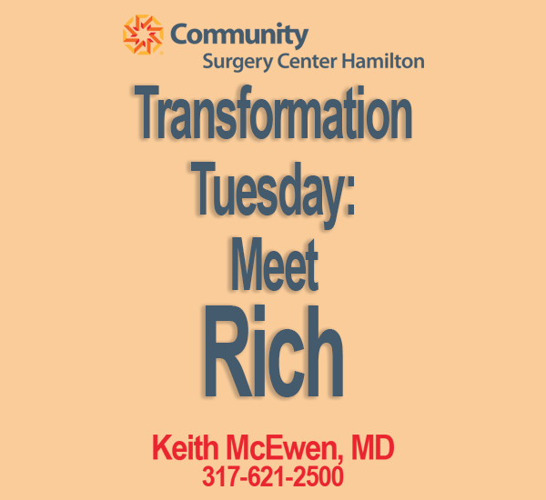 Transformation Tuesday: Rich